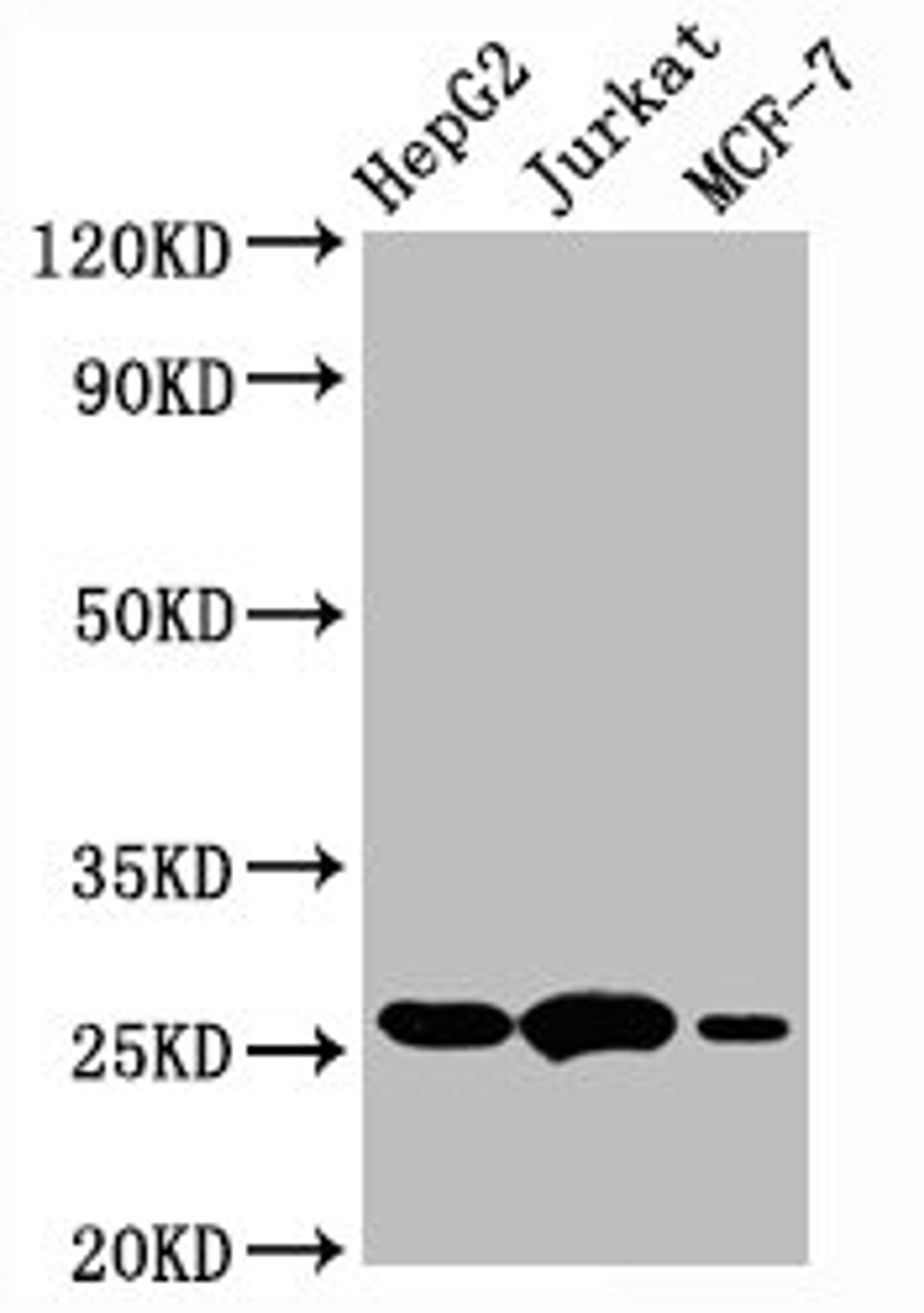 Western Blot. Positive WB detected in:HepG2 whole cell lysate,Jurkat whole cell lysate,MCF-7 whole cell lysate. All lanes:BCL2 antibody at 1&mu;g/ml. Secondary. Goat polyclonal to rabbit IgG at 1/50000 dilution. Predicted band size: 26 KDa. Observed band size: 26 KDa. &nbsp;