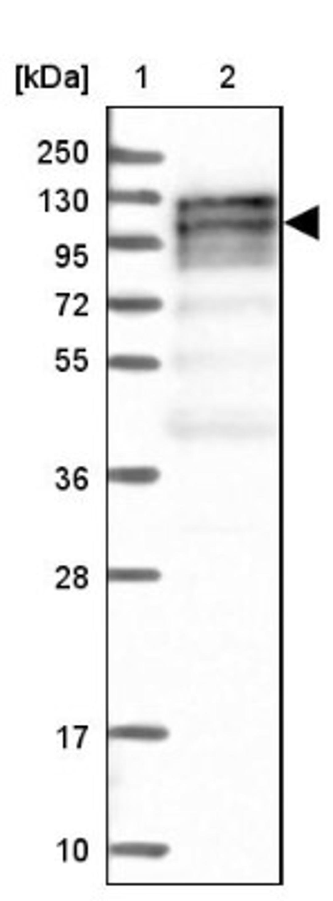 Western Blot: NOL1 Antibody [NBP1-92192] - Lane 1: Marker [kDa] 250, 130, 95, 72, 55, 36, 28, 17, 10<br/>Lane 2: Human cell line RT-4