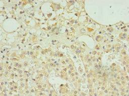 Immunohistochemistry of paraffin-embedded human adrenal gland tissue using CSB-PA855032LA01HU at dilution of 1:100