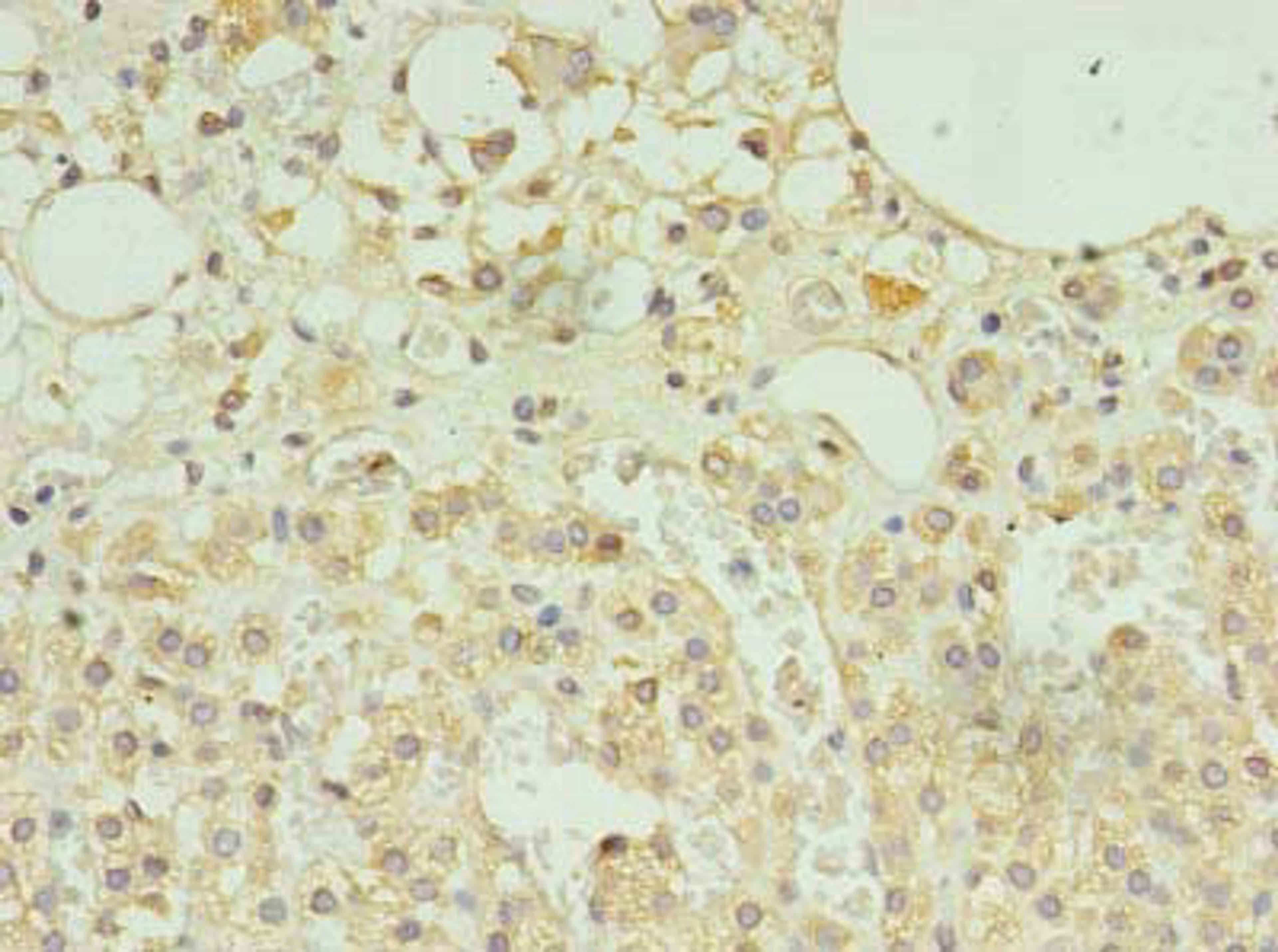 Immunohistochemistry of paraffin-embedded human adrenal gland tissue using CSB-PA855032LA01HU at dilution of 1:100
