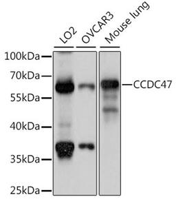 Western blot - CCDC47 antibody (A15871)