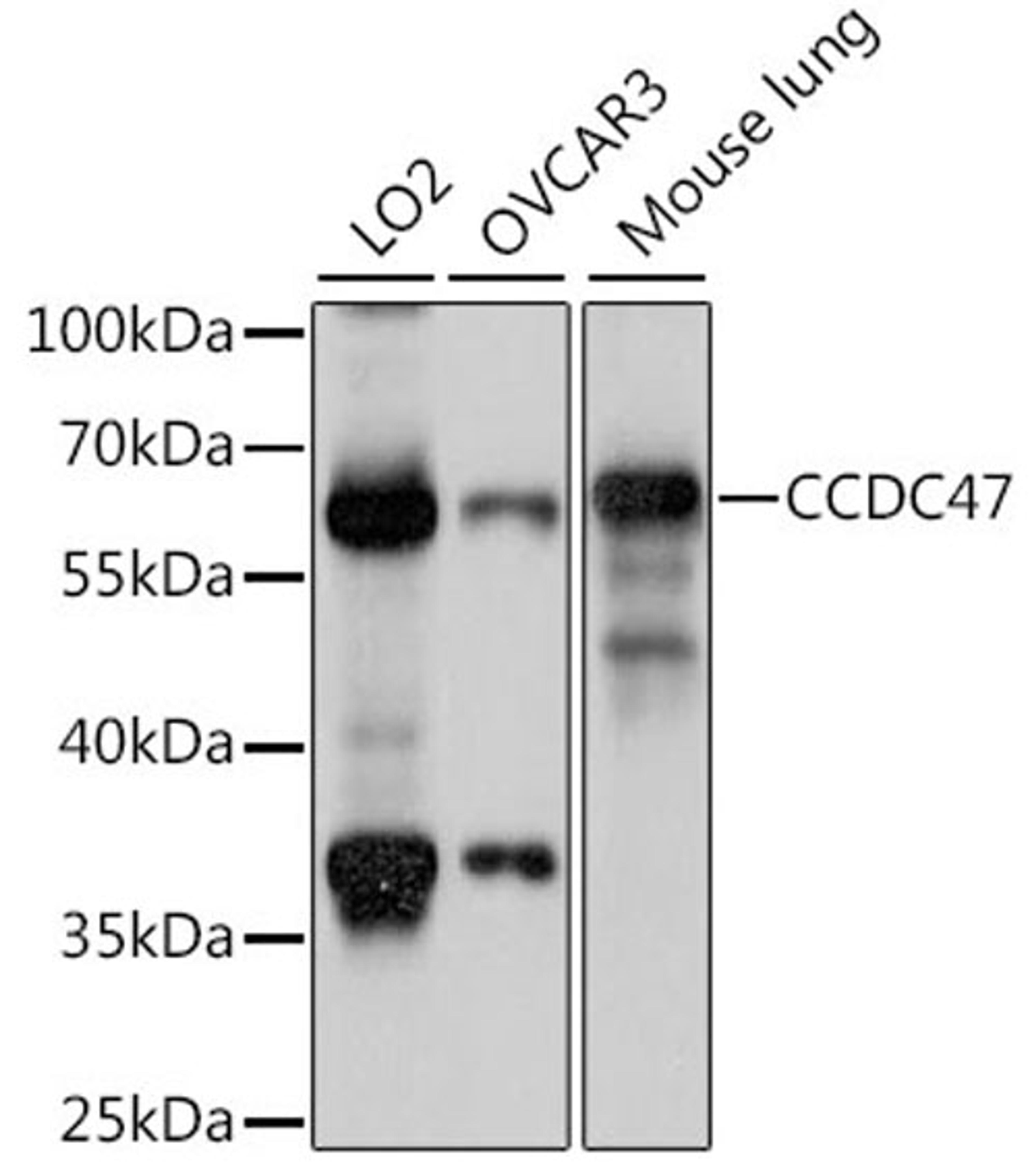 Western blot - CCDC47 antibody (A15871)