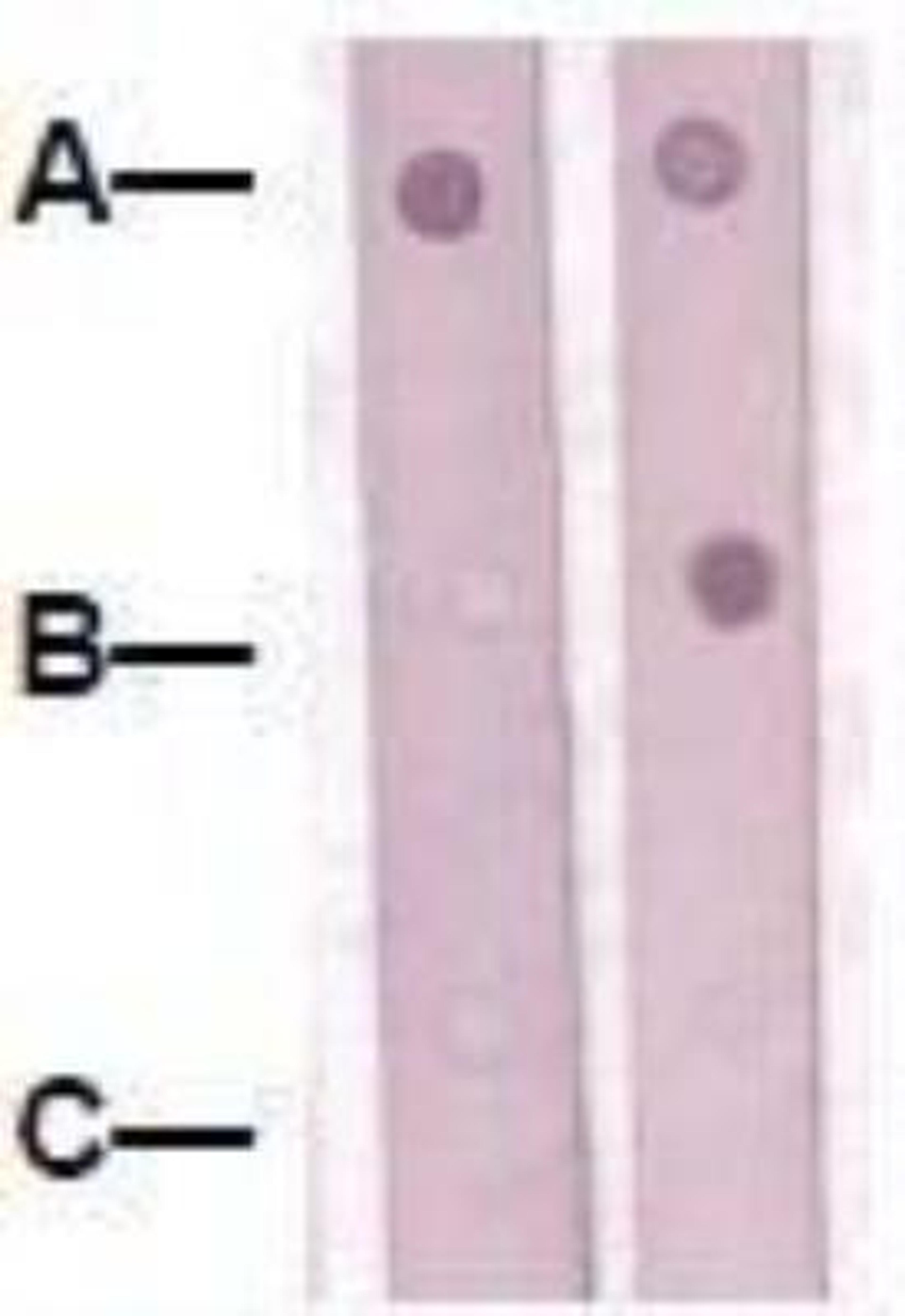 Dot Blot: SOX9 [p Ser181] Antibody [NBP1-74519] - 1 mg peptide was blot onto NC membrane: A: SOX-9 (pS181) / B: SOX-9 (Paired S181)(Nonphospho) / C: Non-related phosphospecific PP were blotted at a 1:1000 dilution by: 1: Rabbit anti-SOX-9 (pS181) / 2: Rabbit anti-SOX-9 (paired 181)