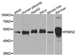 Western blot analysis of extracts of various cell lines using PSEN2 antibody