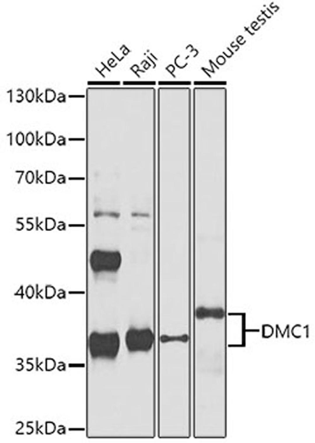 Western blot - DMC1 antibody (A4491)