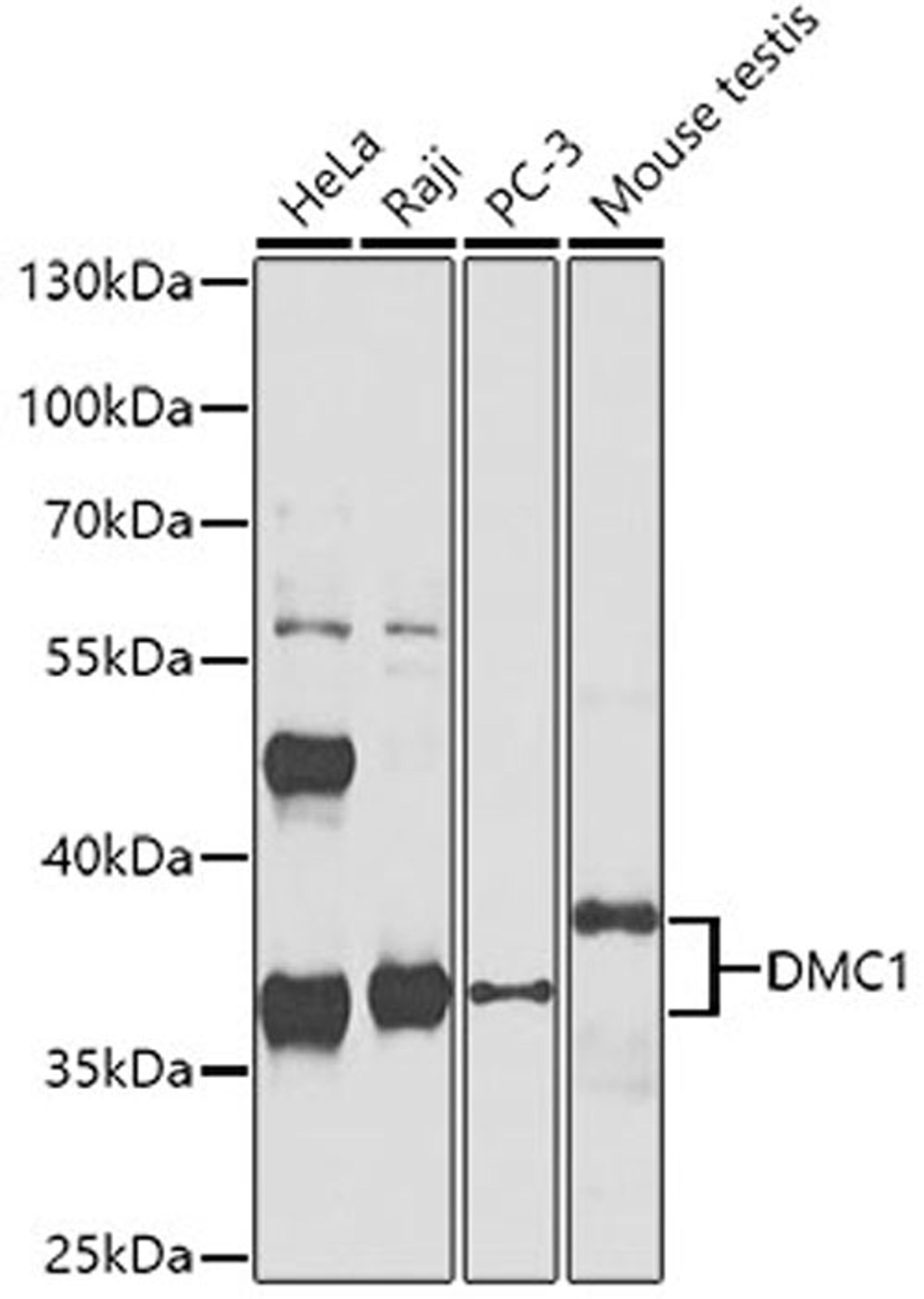 Western blot - DMC1 antibody (A4491)