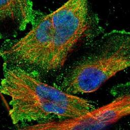 Immunocytochemistry/ Immunofluorescence: C21orf59 Antibody [NBP1-88276] -  Staining of human cell line U-251 MG shows positivity in plasma membrane.