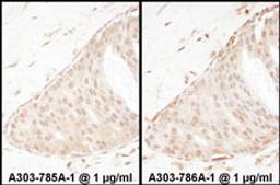 Detection of human Beta-Arrestin 2 by immunohistochemistry.