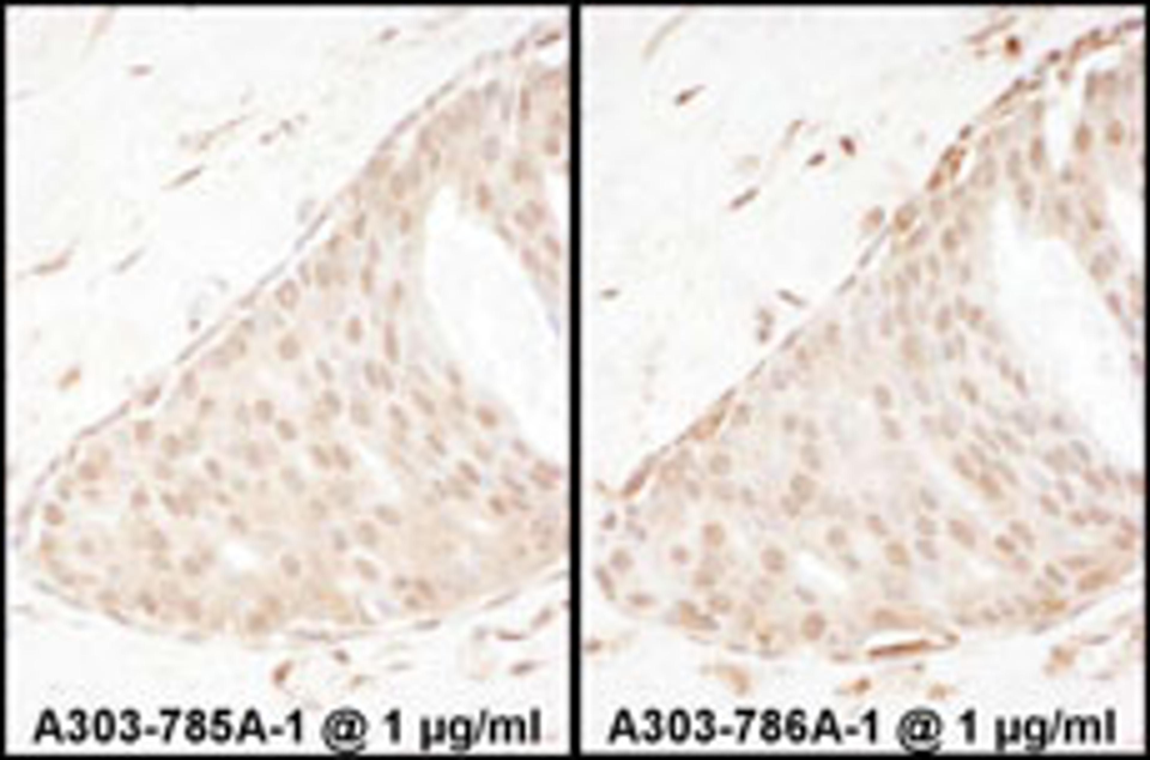 Detection of human Beta-Arrestin 2 by immunohistochemistry.