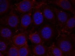 Immunocytochemistry/Immunofluorescence: IGF1 Receptor [p Tyr1165, p Tyr1166] Antibody [NB100-81983] - Staining of methanol-fixed MCF cells using IGF-1R(Phospho-Tyr1165/Tyr1166) antibody