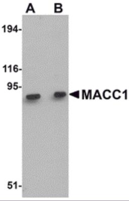 Western blot analysis of MACC1 in mouse liver tissue lysate with MACC1 antibody at (A) 1 and (B) 2 μg/mL.