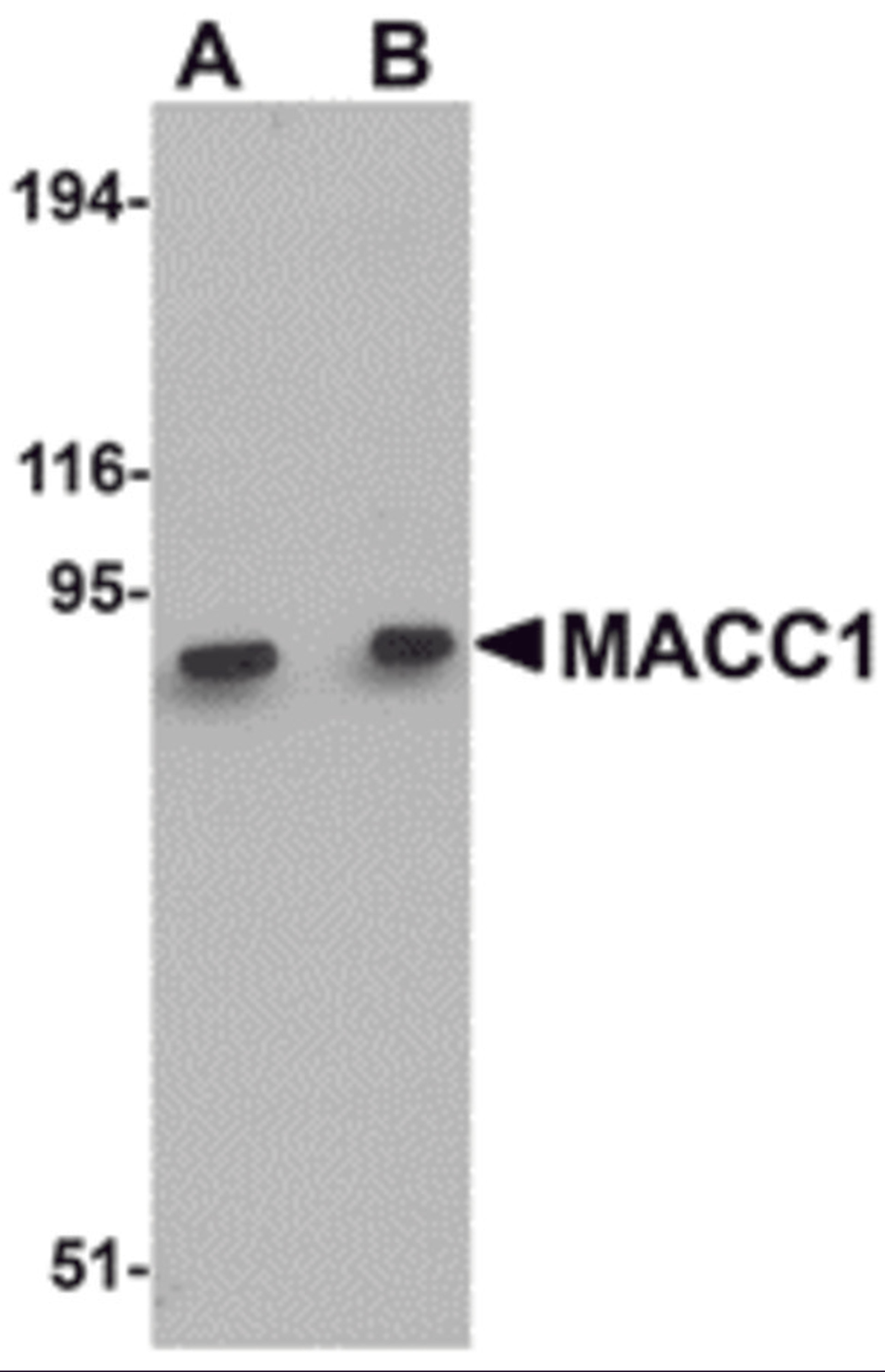 Western blot analysis of MACC1 in mouse liver tissue lysate with MACC1 antibody at (A) 1 and (B) 2 μg/mL.