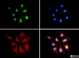 Immunocytochemistry/Immunofluorescence: HA95/AKAP8L Antibody [NBP1-79140] - HA95/AKAP8L antibody was tested in HeLa cells with DyLight 488 (green). Nuclei and alpha Tubulin (NB100-690) were counterstained with DAPI (blue) and DyLight 550 (red).