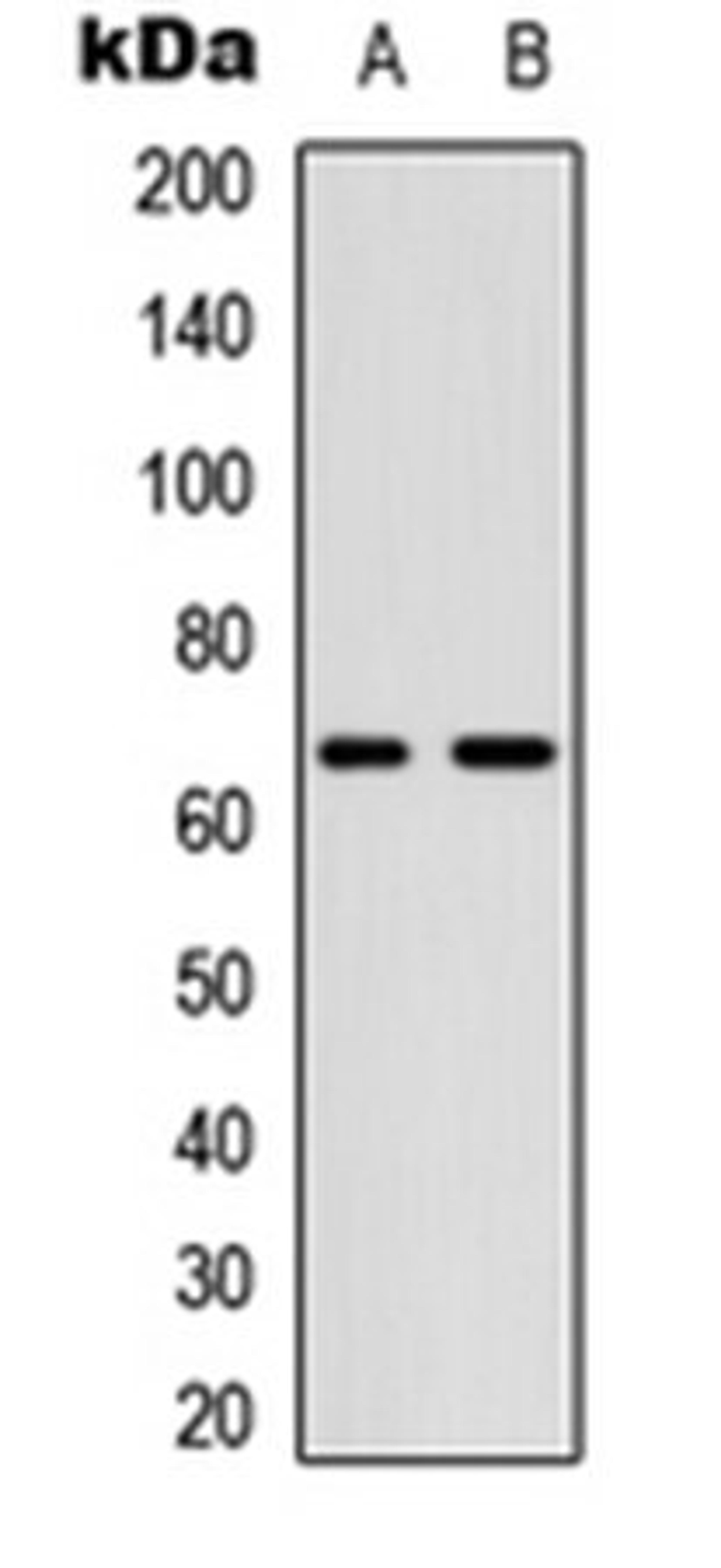 Western blot analysis of A549 (Lane 1), NIH3T3 (Lane 2) whole cell lysates using CDC25B (phospho-S323) antibody