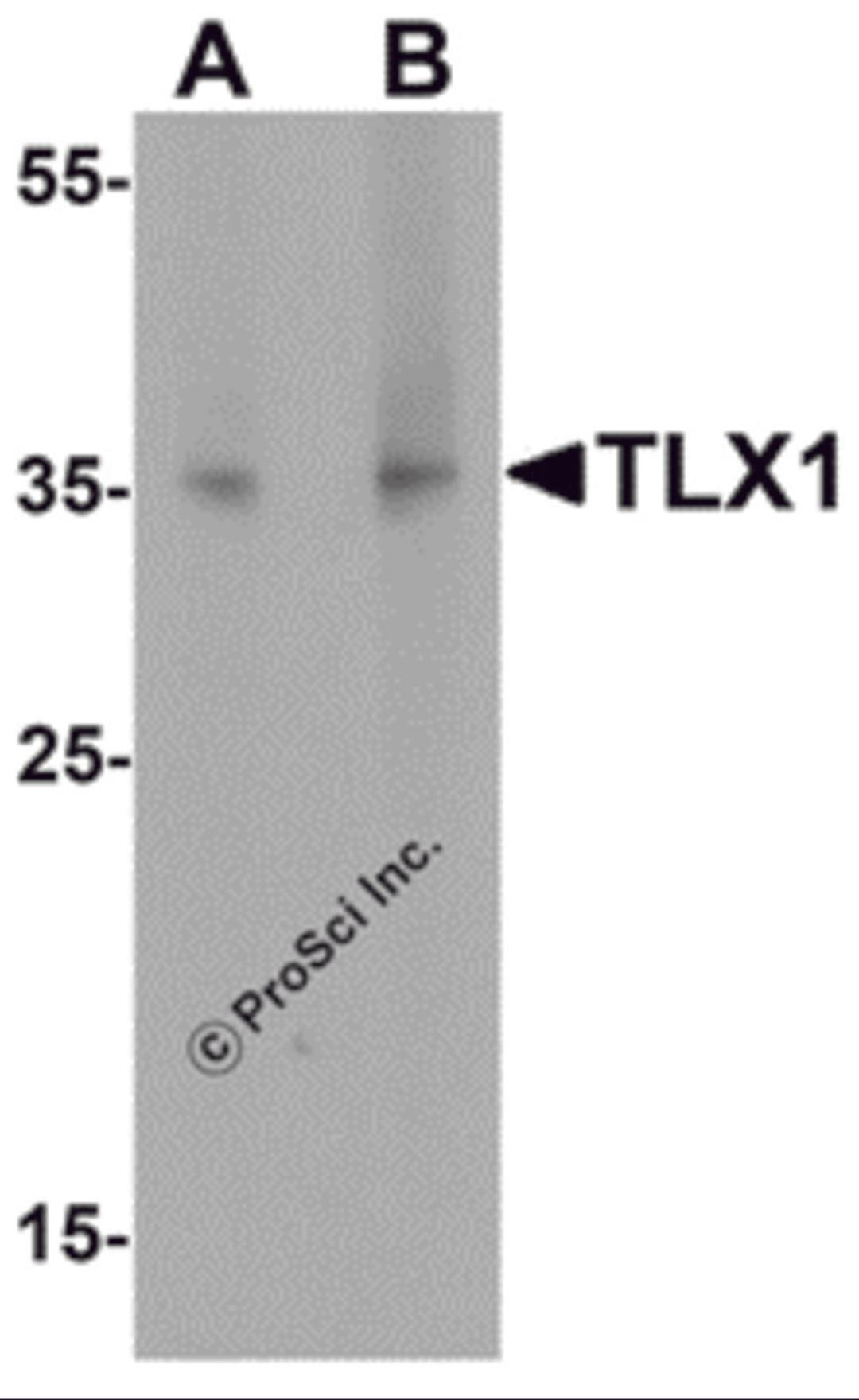 Western blot analysis of TLX1 in mouse spleen tissue lysate with TLX1 antibody at (A) 1 &#956;g/mL and (B) 2 &#956;g/mL.