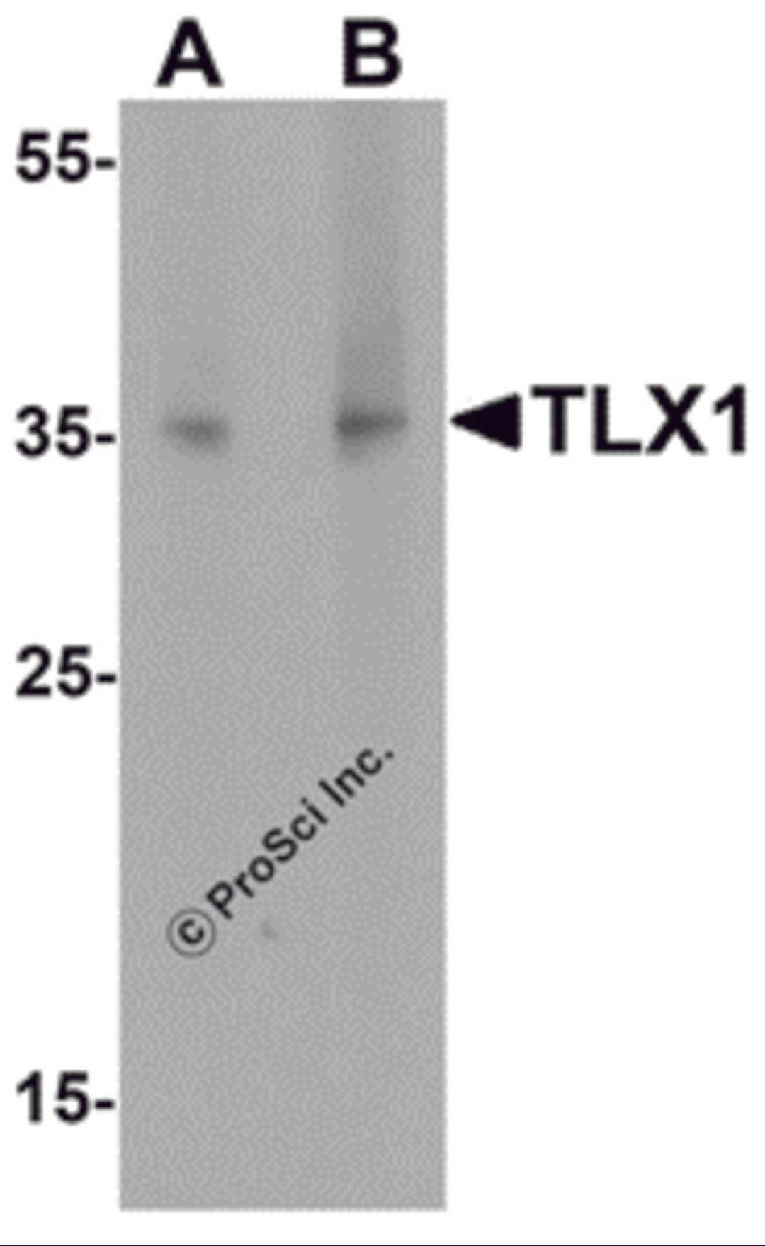 Western blot analysis of TLX1 in mouse spleen tissue lysate with TLX1 antibody at (A) 1 μg/mL and (B) 2 μg/mL.