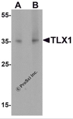 Western blot analysis of TLX1 in mouse spleen tissue lysate with TLX1 antibody at (A) 1 μg/mL and (B) 2 μg/mL.