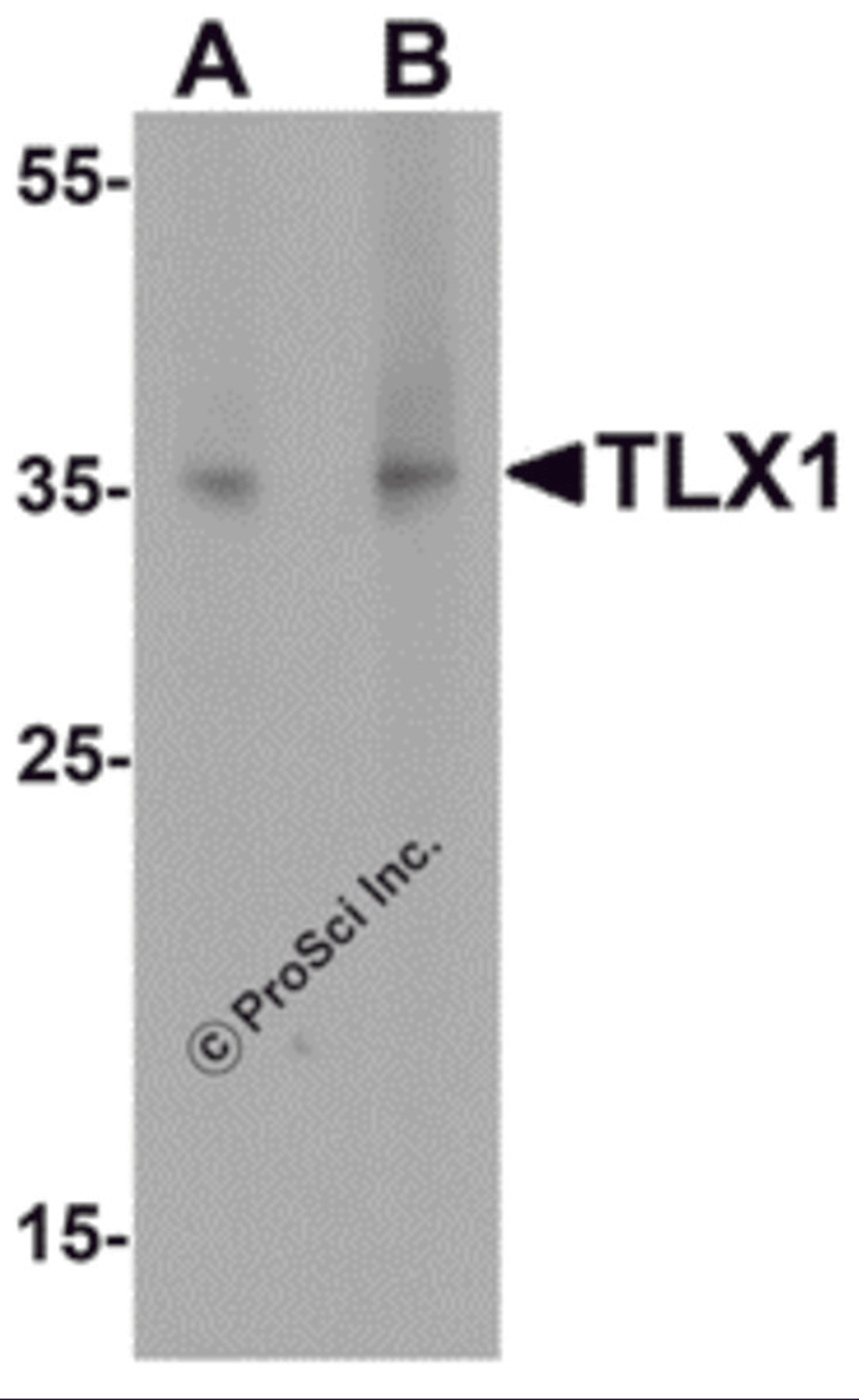 Western blot analysis of TLX1 in mouse spleen tissue lysate with TLX1 antibody at (A) 1 μg/mL and (B) 2 μg/mL.