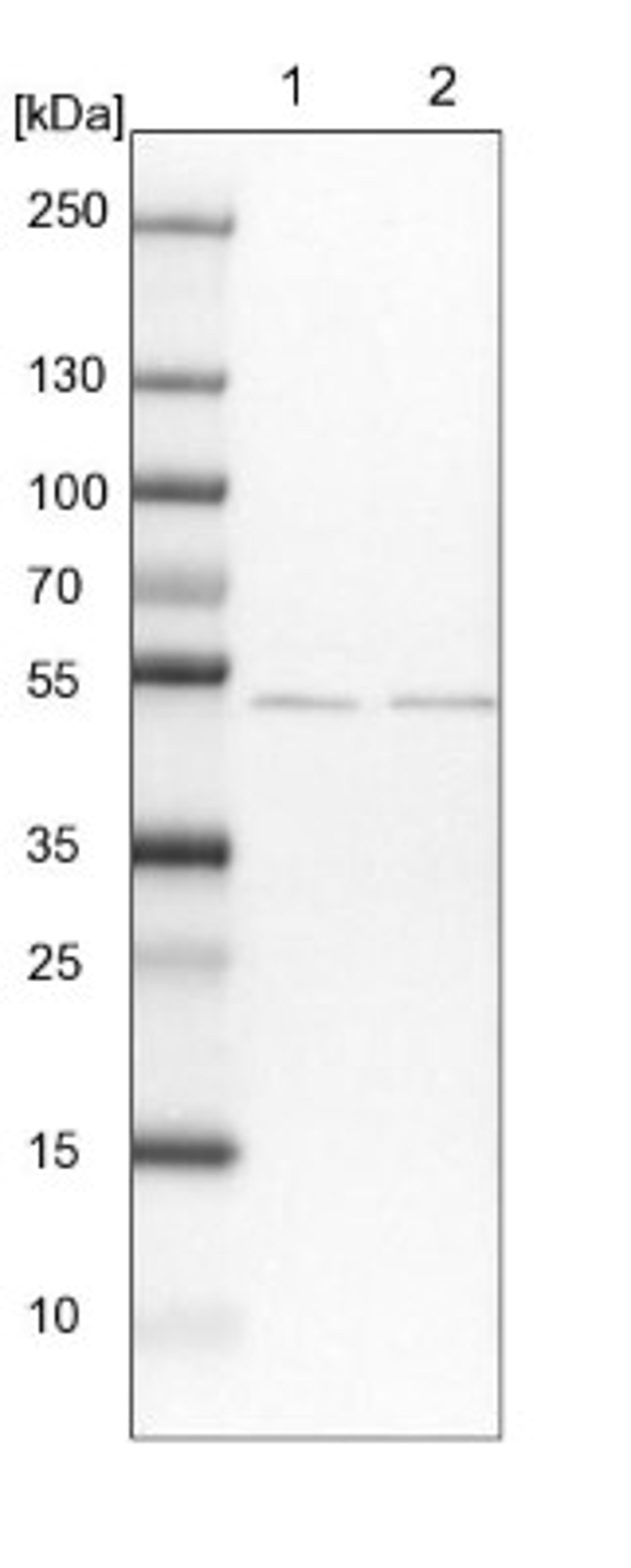 Western Blot: MKRN2 Antibody [NBP1-83179] - Lane 1: NIH-3T3 cell lysate (Mouse embryonic fibroblast cells)<br/>Lane 2: NBT-II cell lysate (Rat Wistar bladder tumour cells)