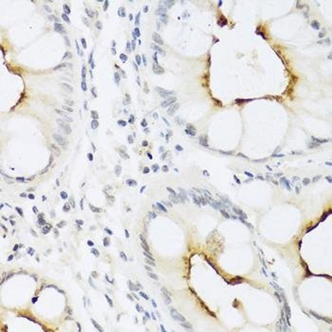 Immunohistochemical staining of rat kidney tissue using CCL22 antibody (dilution of 1:100)