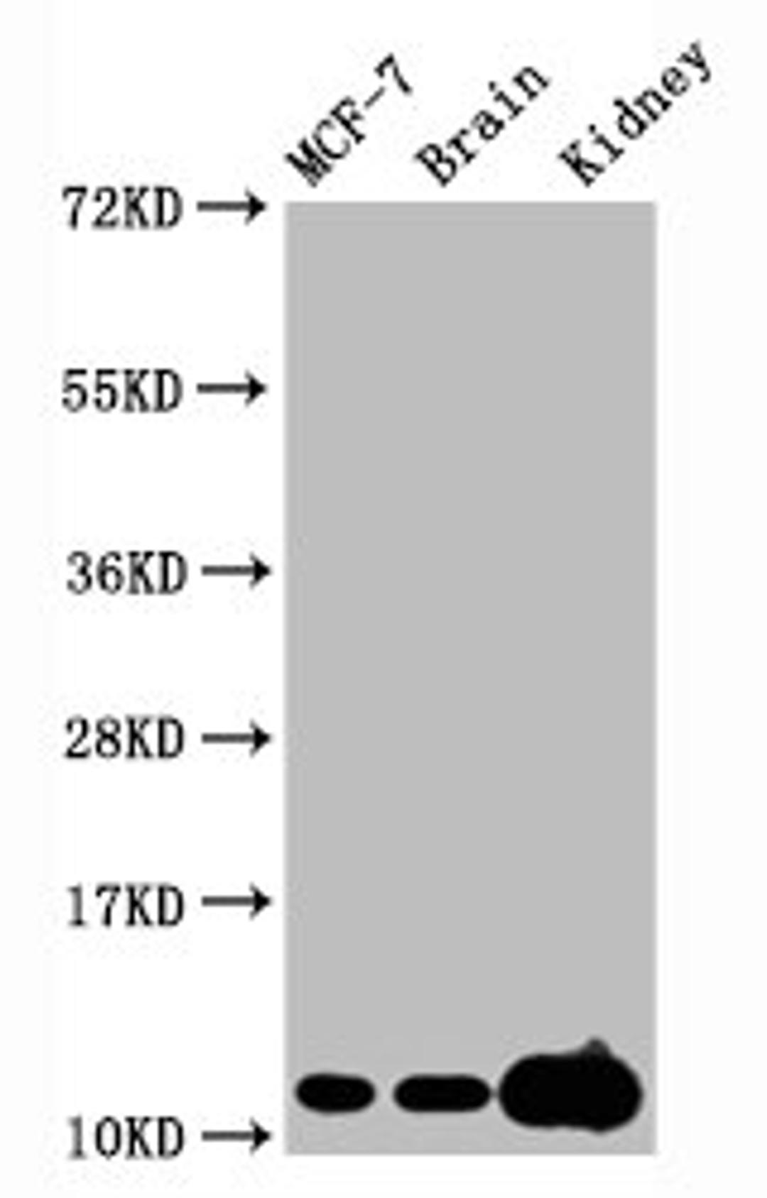 Western Blot. Positive WB detected in MCF-7 whole cell lysate锛孧ouse brain tissue,Mouse kidney tissue. All lanes Tri-methyl-Histone H4 (K20) antibody at 2.15μg/ml. Secondary. Goat polyclonal to rabbit IgG at 1/50000 dilution. Predicted band size: 11 KDa. Observed band size: 11 KDa.