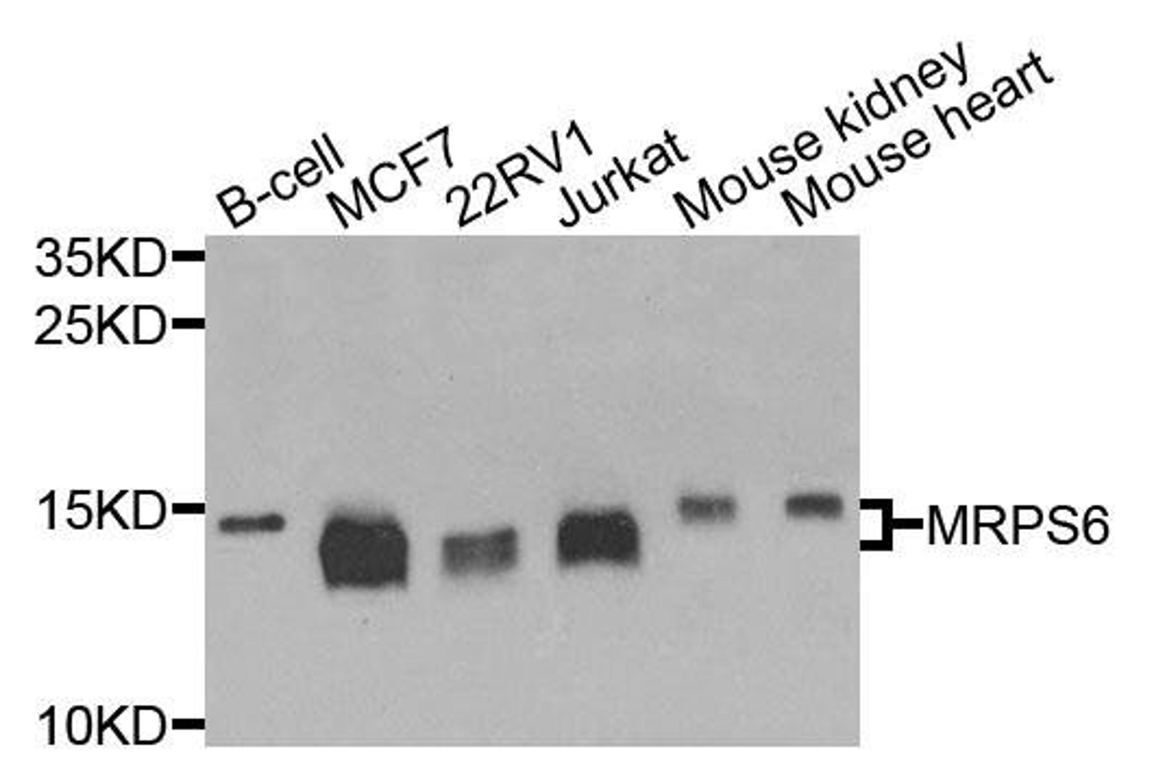 Western blot analysis of extracts of various cells using MRPS6 antibody