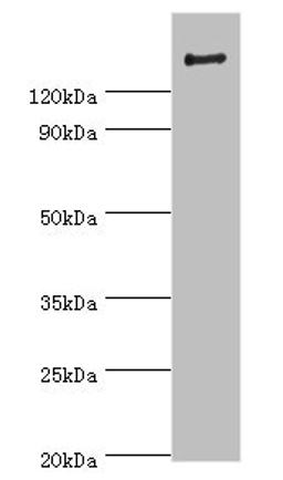 Western blot. All lanes: ROCK2 antibody at 2ug/ml + Rat brain tissue. Secondary. Goat polyclonal to rabbit IgG at 1/10000 dilution. Predicted band size: 161 kDa. Observed band size: 161 kDa. 