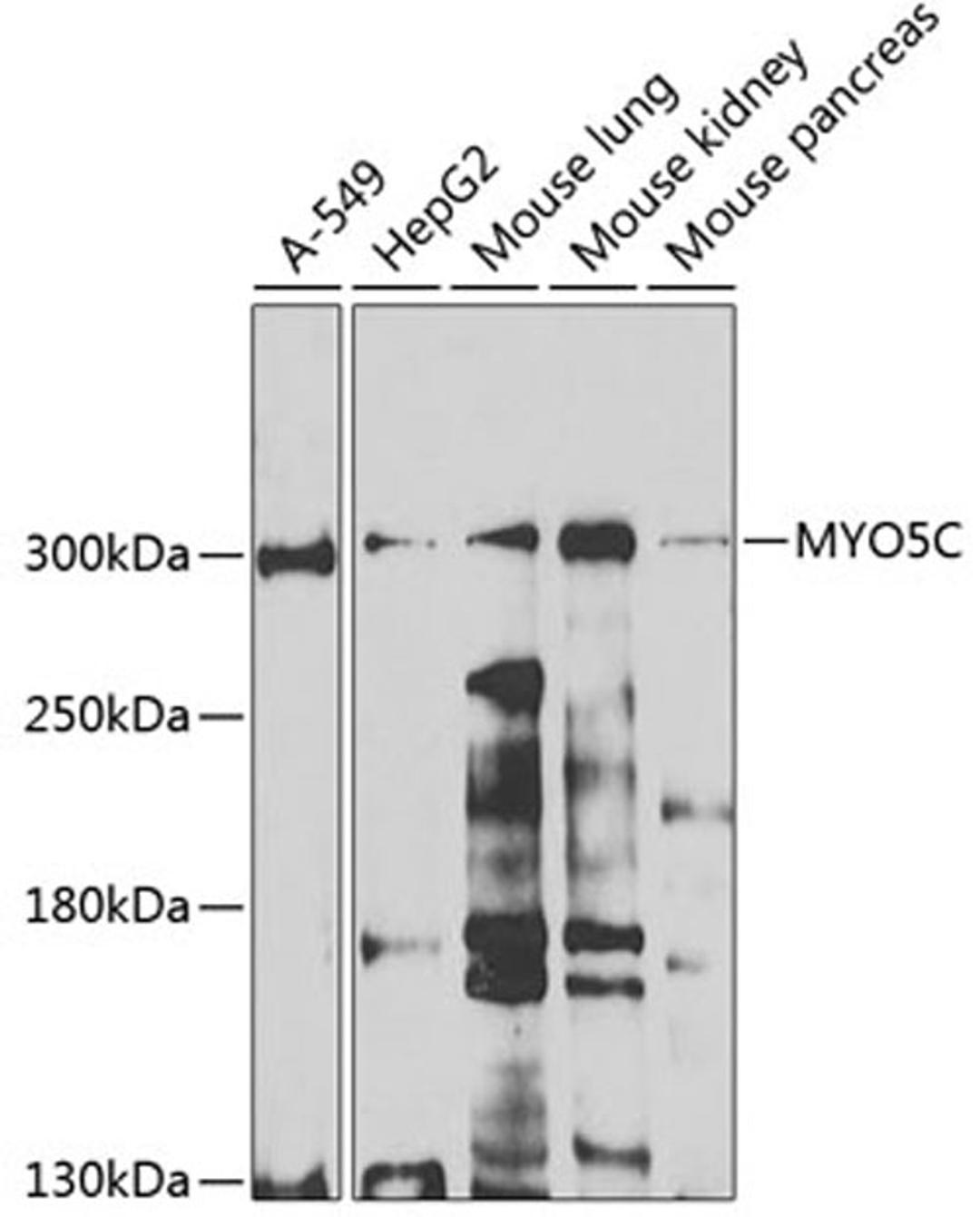 Western blot - MYO5C antibody (A7597)