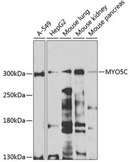 Western blot - MYO5C antibody (A7597)