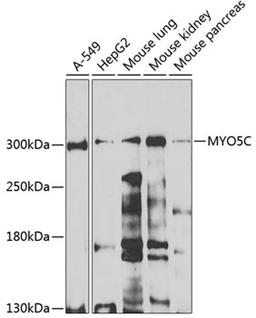 Western blot - MYO5C antibody (A7597)
