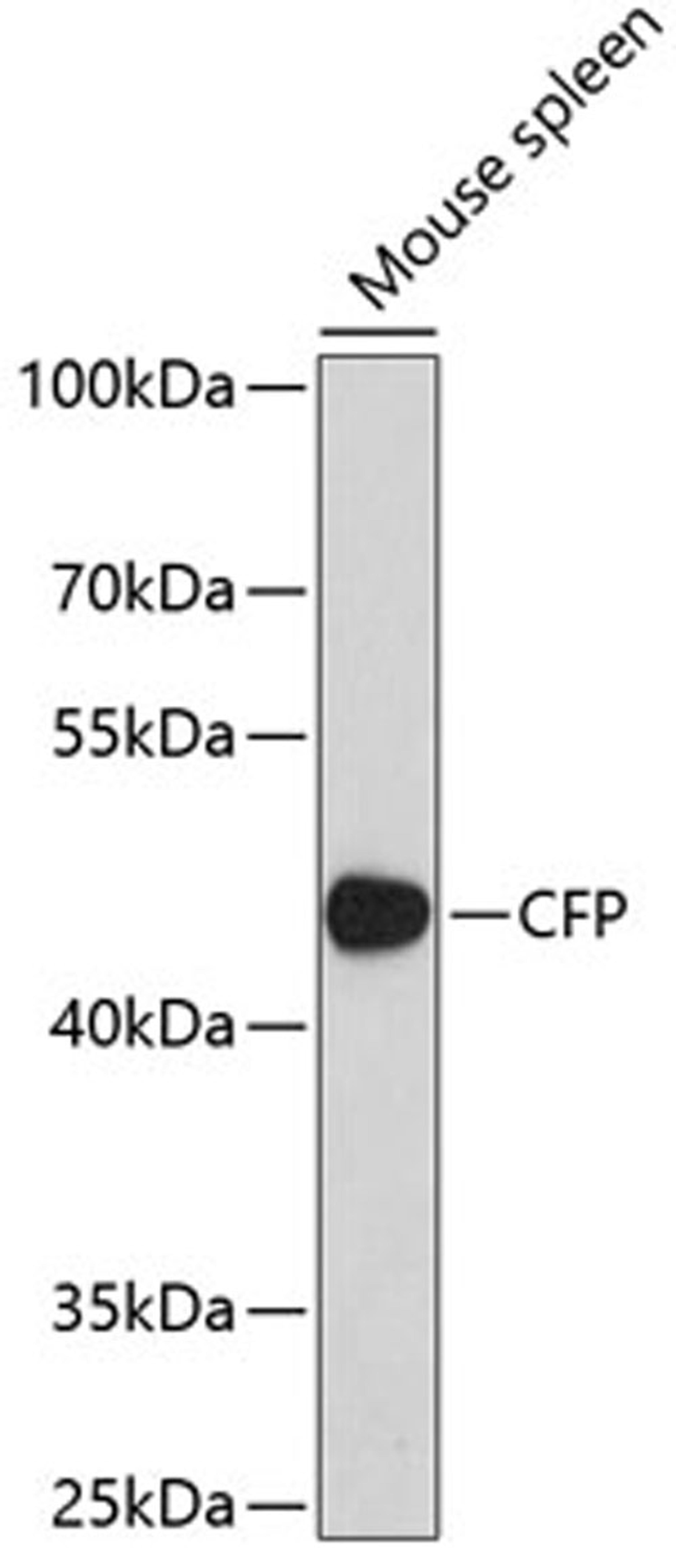 Western blot - CFP antibody (A5398)