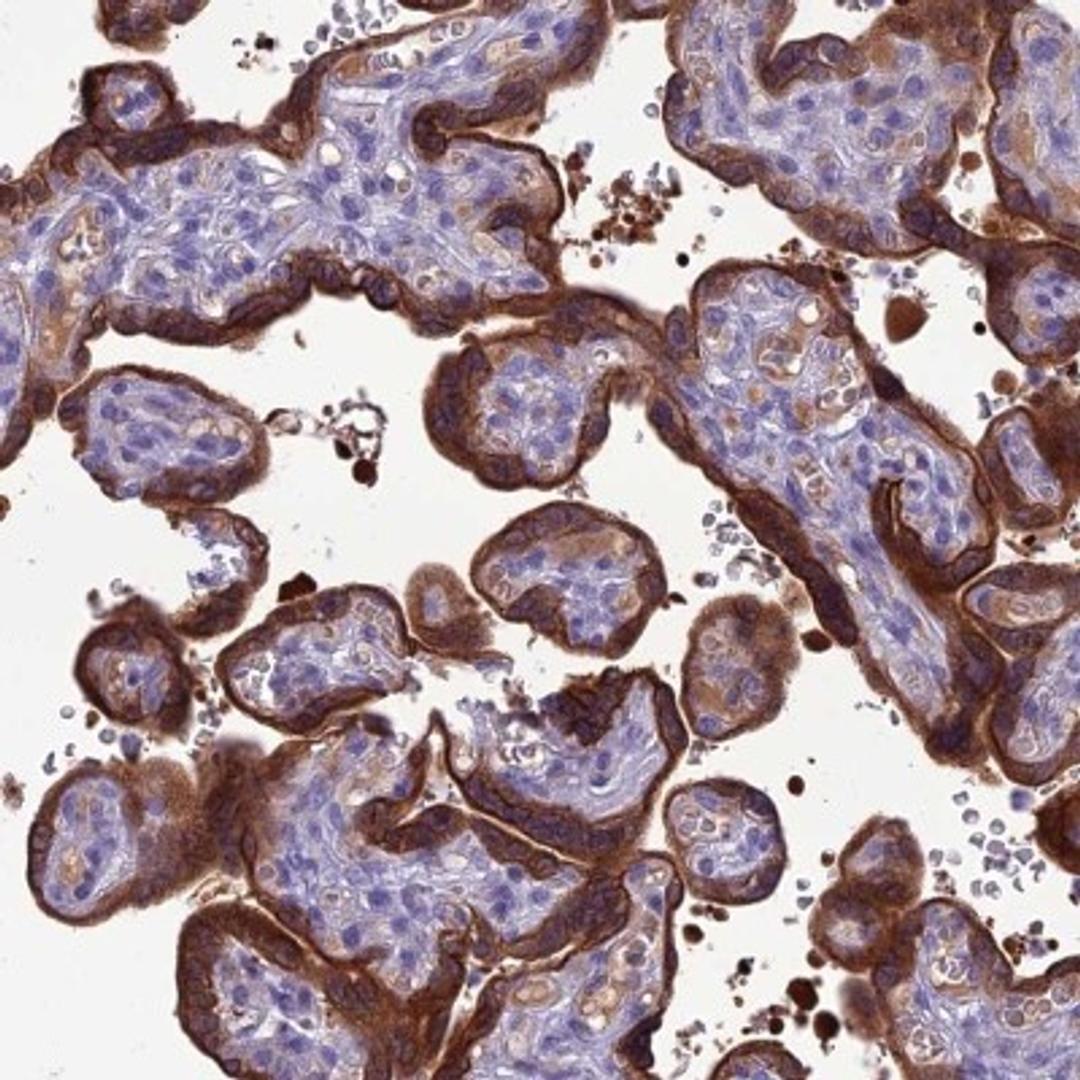 Immunohistochemistry-Paraffin: SPTLC3 Antibody [NBP2-33418] - Immunohistochemical staining of human placenta shows strong cytoplasmic and membranous positivity in trophoblastic cells.