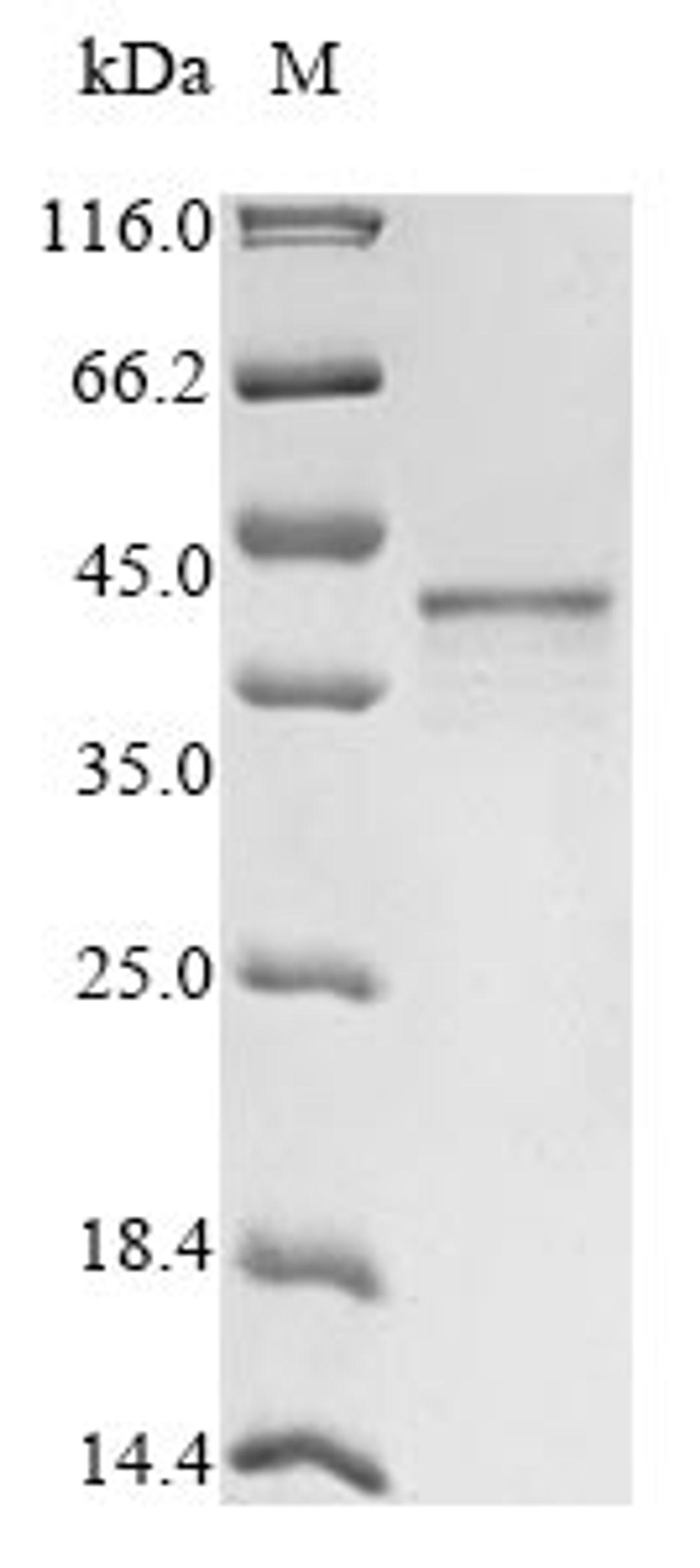 (Tris-Glycine gel) Discontinuous SDS-PAGE (reduced) with 5% enrichment gel and 15% separation gel.