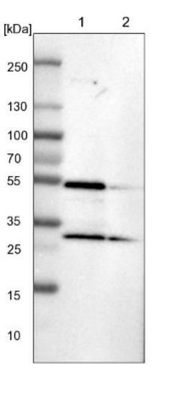 Western Blot: SLC25A25 Antibody [NBP1-82886] - Lane 1: NIH-3T3 cell lysate (Mouse embryonic fibroblast cells)<br/>Lane 2: NBT-II cell lysate (Rat Wistar bladder tumour cells)