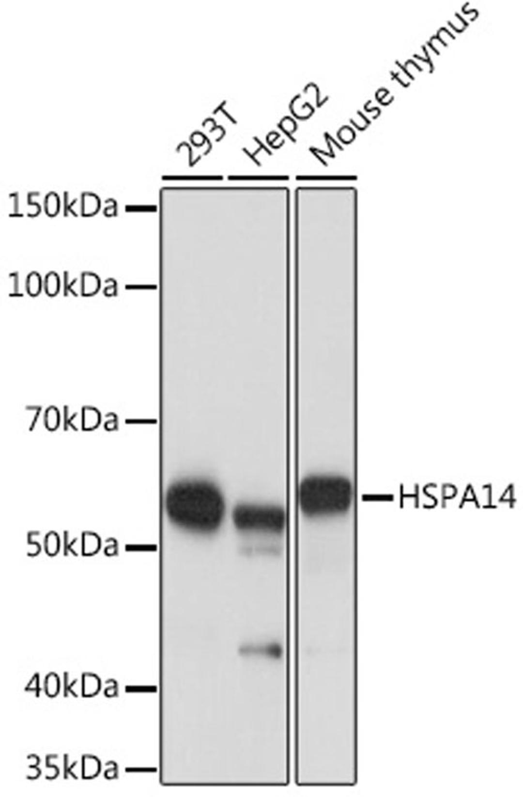 Western blot - HSPA14 Rabbit mAb (A2286)