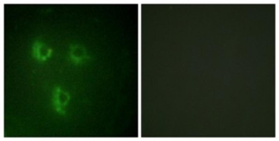 Immunocytochemistry/Immunofluorescence: TMEPAI Antibody [NBP1-55696] - Analysis of HuvEc cells, using TMEPAI Antibody. The picture on the right is treated with the synthesized peptide.