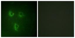 Immunocytochemistry/Immunofluorescence: TMEPAI Antibody [NBP1-55696] - Analysis of HuvEc cells, using TMEPAI Antibody. The picture on the right is treated with the synthesized peptide.