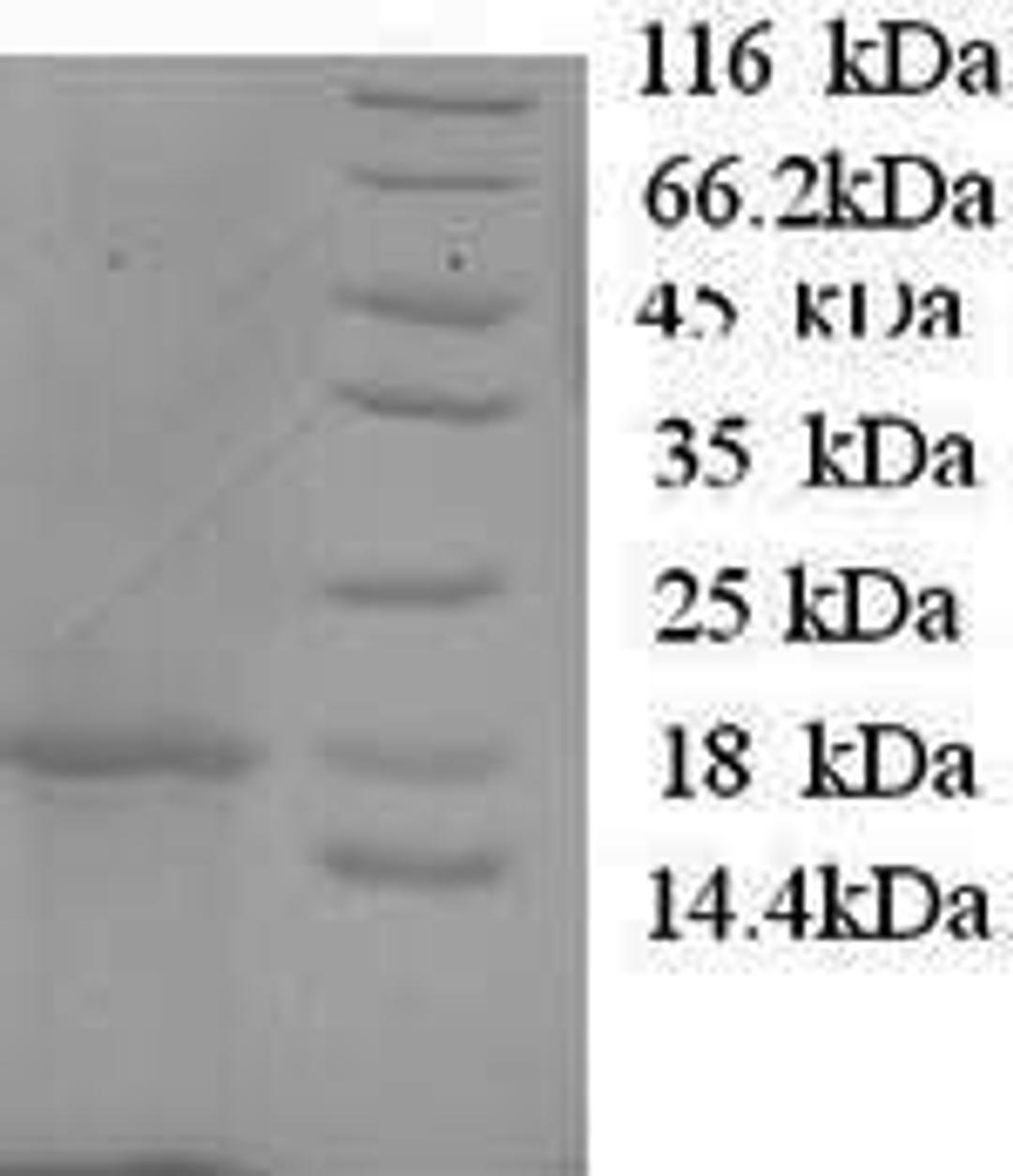 (Tris-Glycine gel) Discontinuous SDS-PAGE (reduced) with 5% enrichment gel and 15% separation gel.