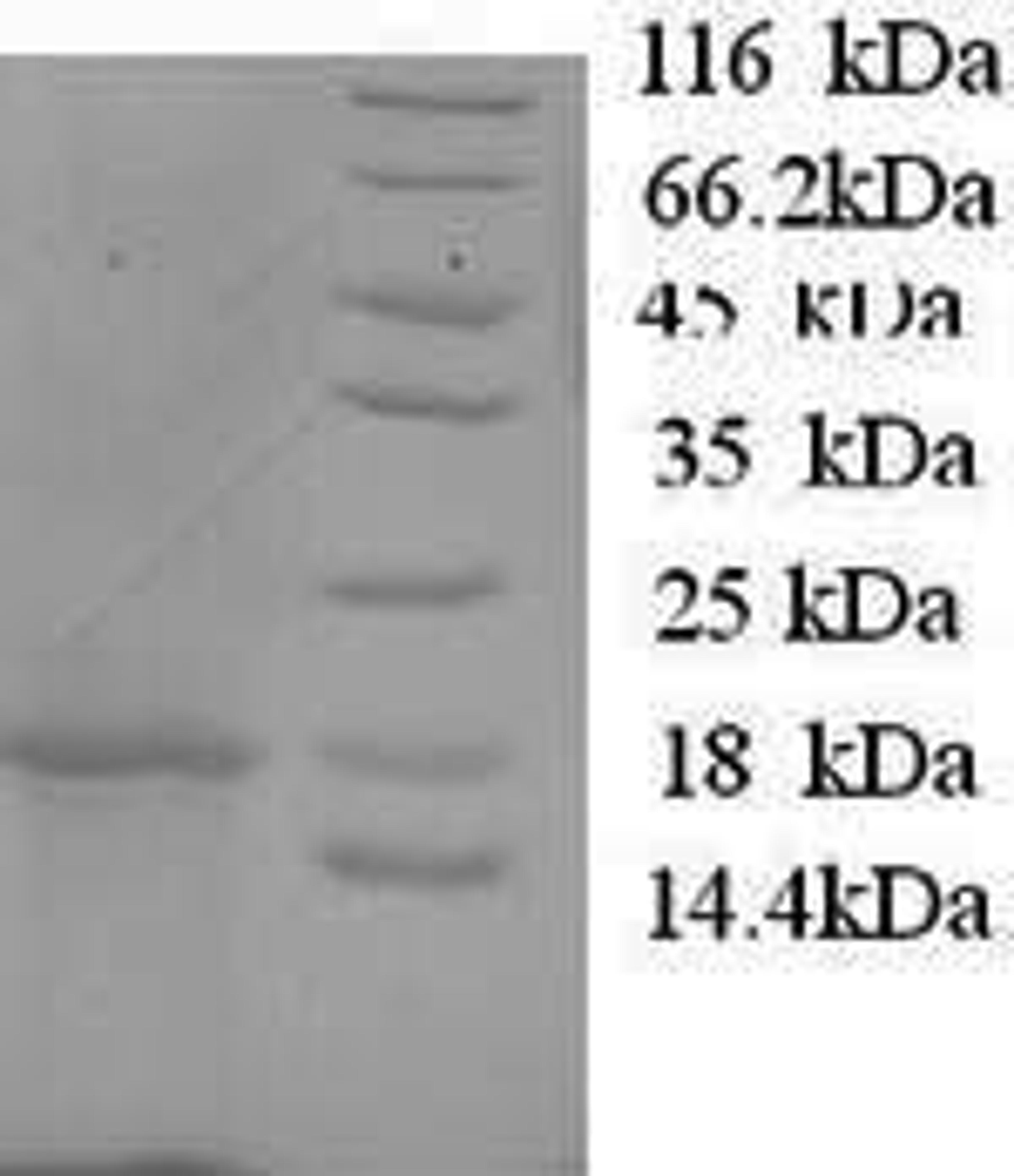 (Tris-Glycine gel) Discontinuous SDS-PAGE (reduced) with 5% enrichment gel and 15% separation gel.
