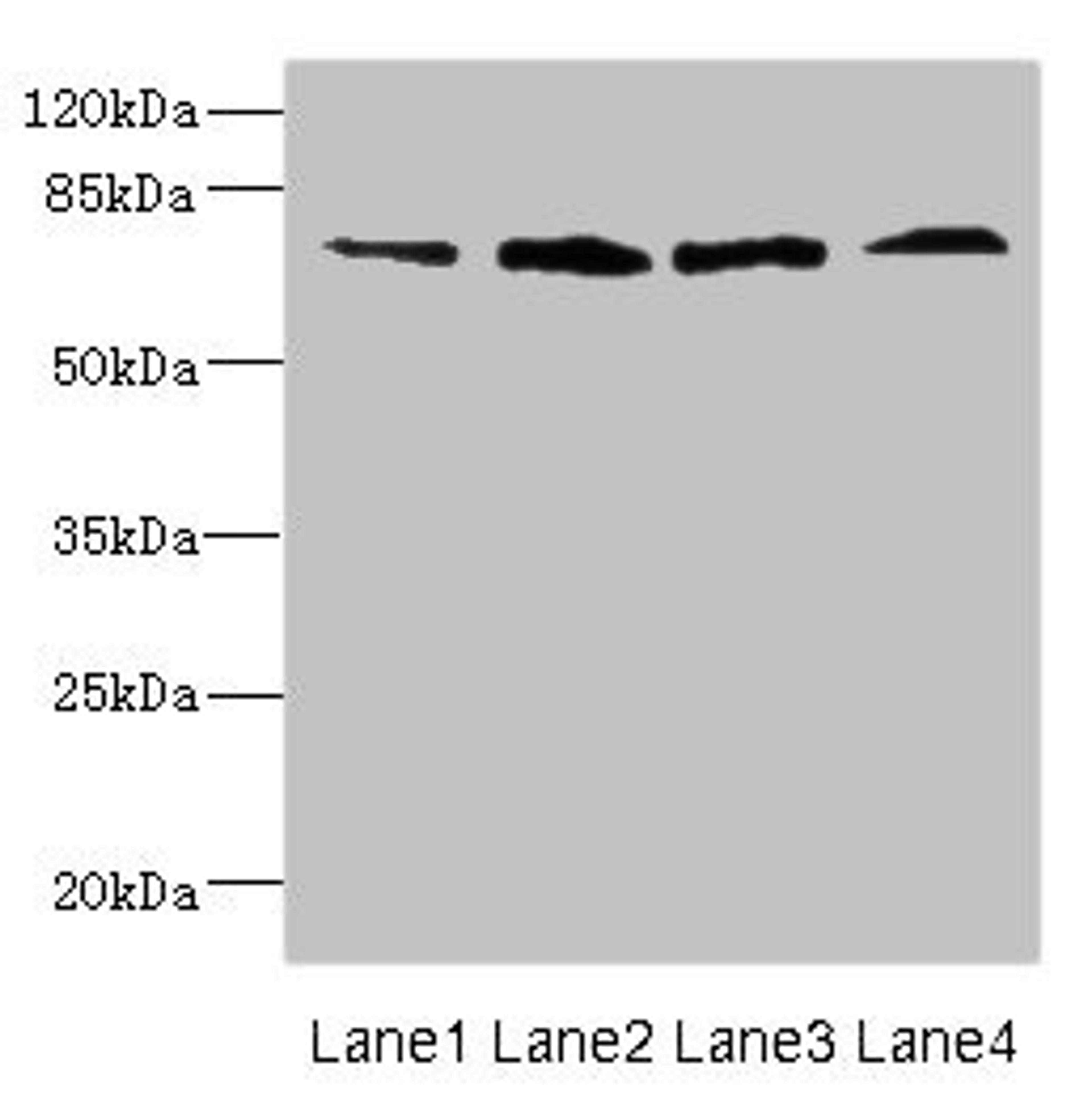 Western blot. All lanes: DARS2 antibody at 16ug/ml. Lane 1: Mouse heart tissue. Lane 2: Mouse liver tissue. Lane 3: Mouse brain tissue. Lane 4: Mouse skeletal muscle tissue. Secondary. Goat polyclonal to rabbit IgG at 1/10000 dilution. Predicted band size: 73 kDa. Observed band size: 73 kDa. 