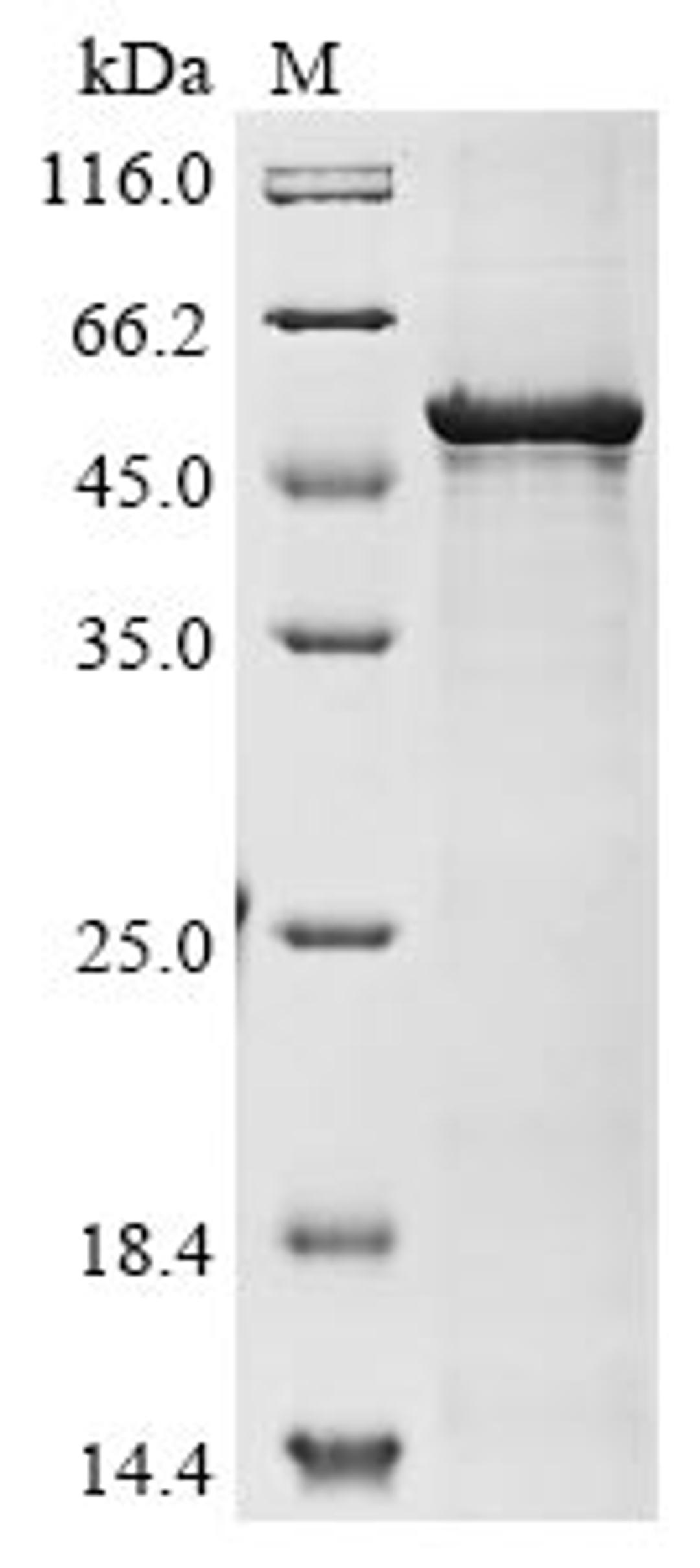 (Tris-Glycine gel) Discontinuous SDS-PAGE (reduced) with 5% enrichment gel and 15% separation gel.