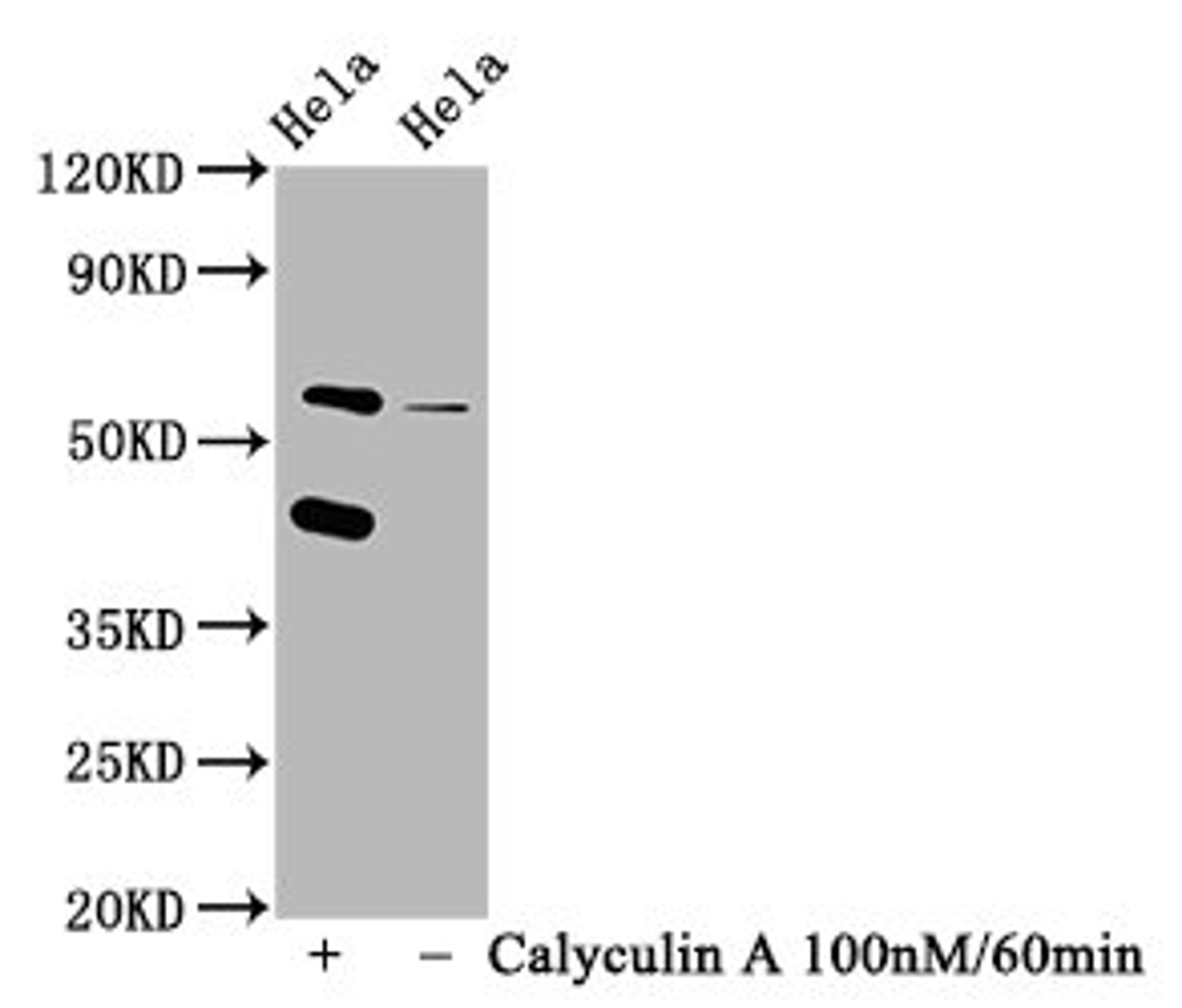 Western Blot. Positive WB detected in Hela whole cell lysate(treated with Calyculin A or not). All lanes Phospho-EIF2AK2 antibody at 1.25μg/ml. Secondary. Goat polyclonal to rabbit IgG at 1/50000 dilution. Predicted band size: 62 KDa. Observed band size: 62 KDa.