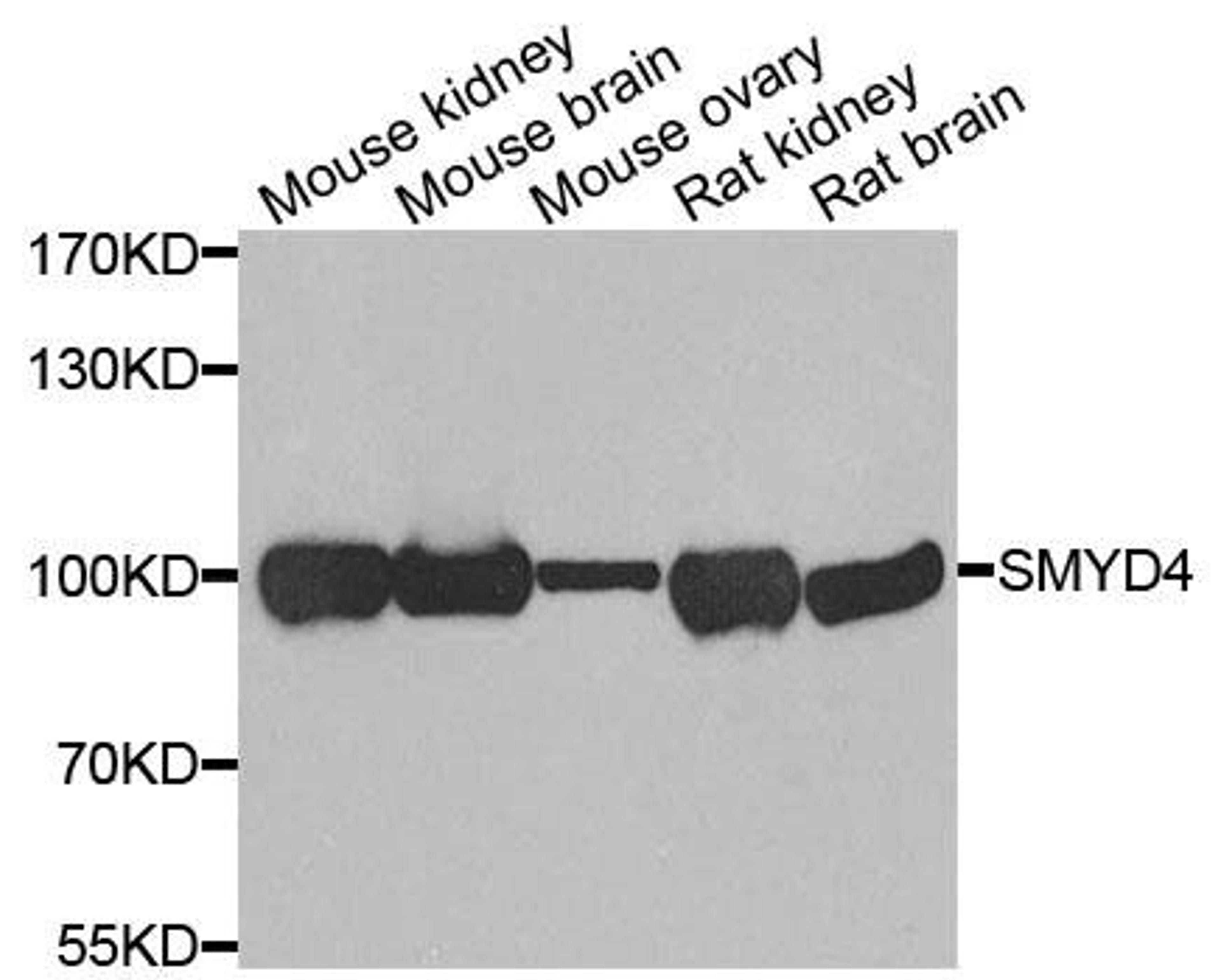 Western blot analysis of extracts of various cells using SMYD4 antibody