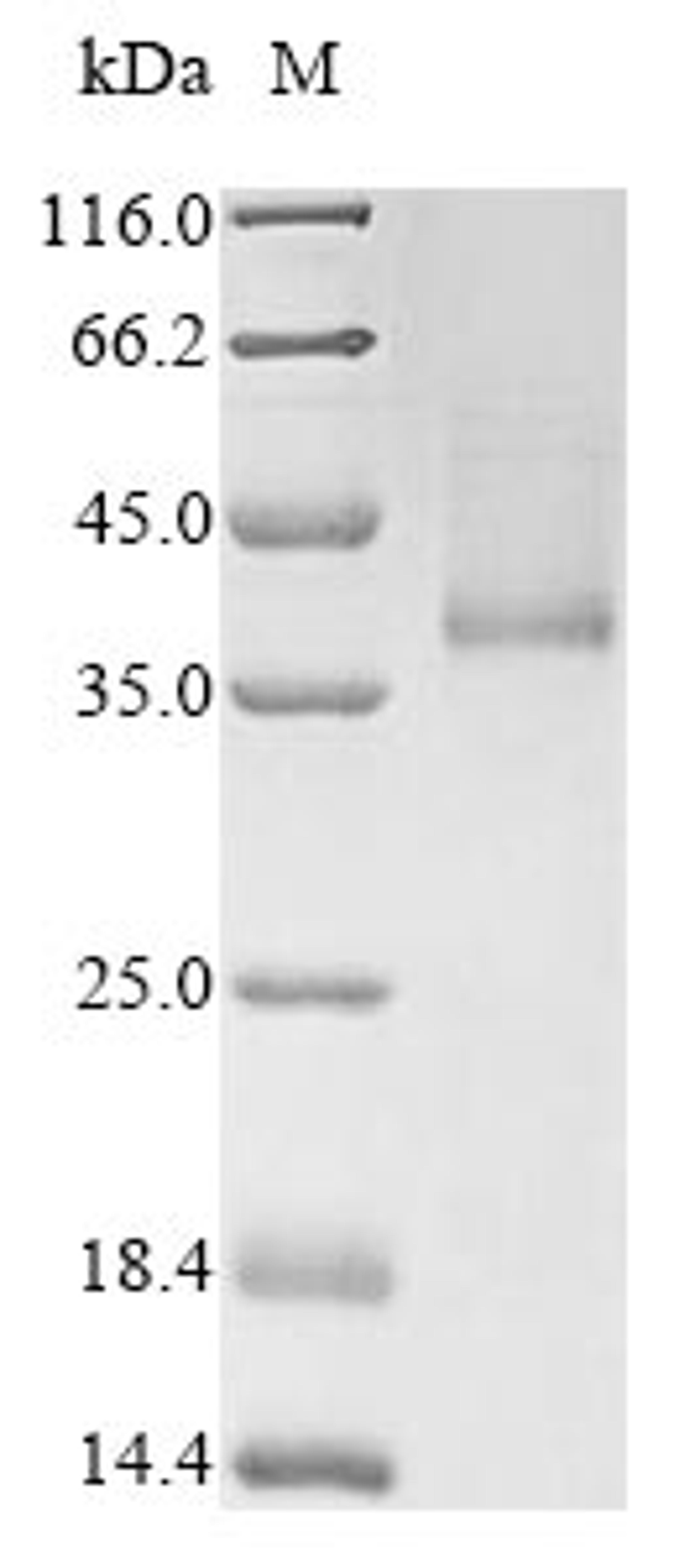 (Tris-Glycine gel) Discontinuous SDS-PAGE (reduced) with 5% enrichment gel and 15% separation gel.