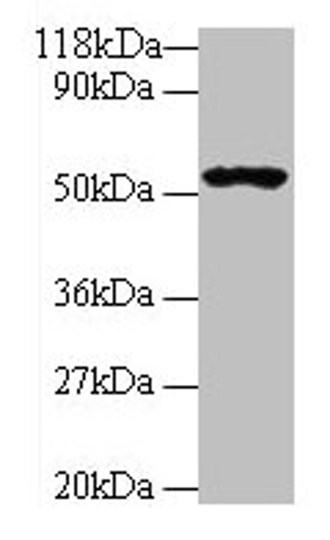 Western blot. All lanes: GLP1R antibody at 2µg/ml + 293T whole cell lysate. Secondary. Goat polyclonal to rabbit IgG at 1/10000 dilution. Predicted band size: 54 kDa. Observed band size: 54 kDa