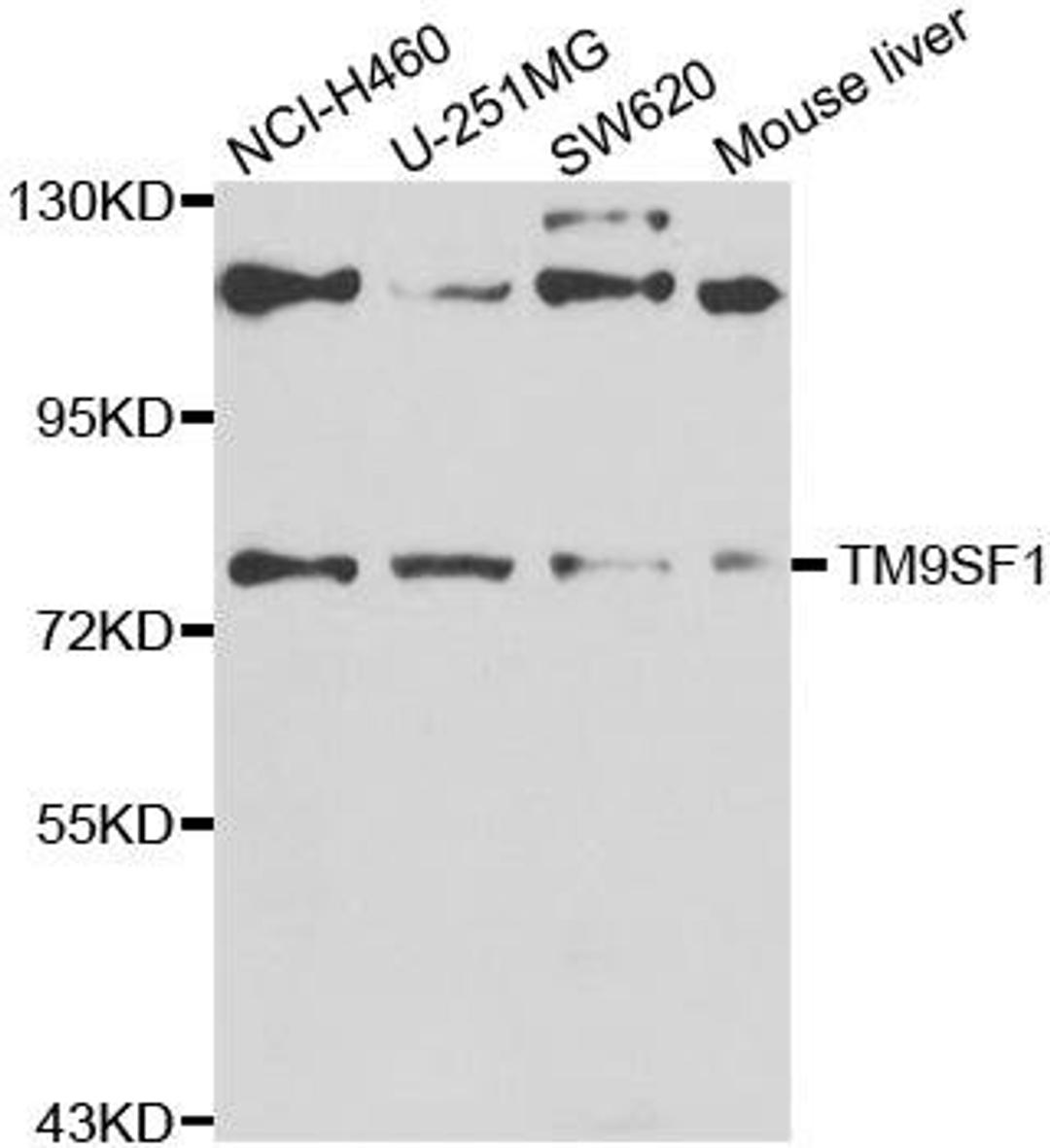 Western blot analysis of extracts of various cell lines using TM9SF1 antibody