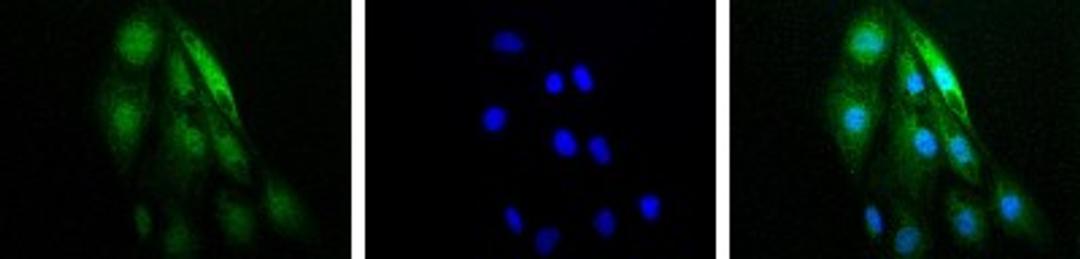 Immunocytochemistry/Immunofluorescence: HIF-1 alpha Antibody [NB100-479] - Detection of HIF-1 Alpha (green) in RCC4 cells using NB100-479. Nuclei (Blue) were counterstained using Hoechst 33258.