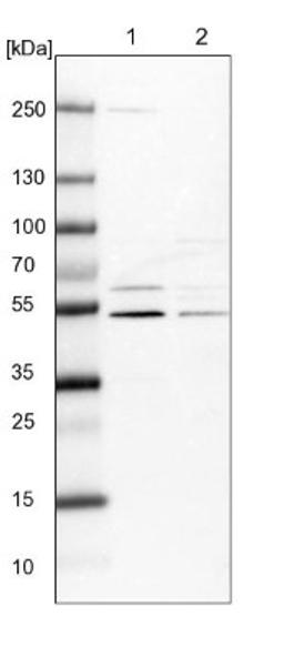 Western Blot: AMDHD1 Antibody [NBP1-82701] - Lane 1: NIH-3T3 cell lysate (Mouse embryonic fibroblast cells)<br/>Lane 2: NBT-II cell lysate (Rat Wistar bladder tumour cells)