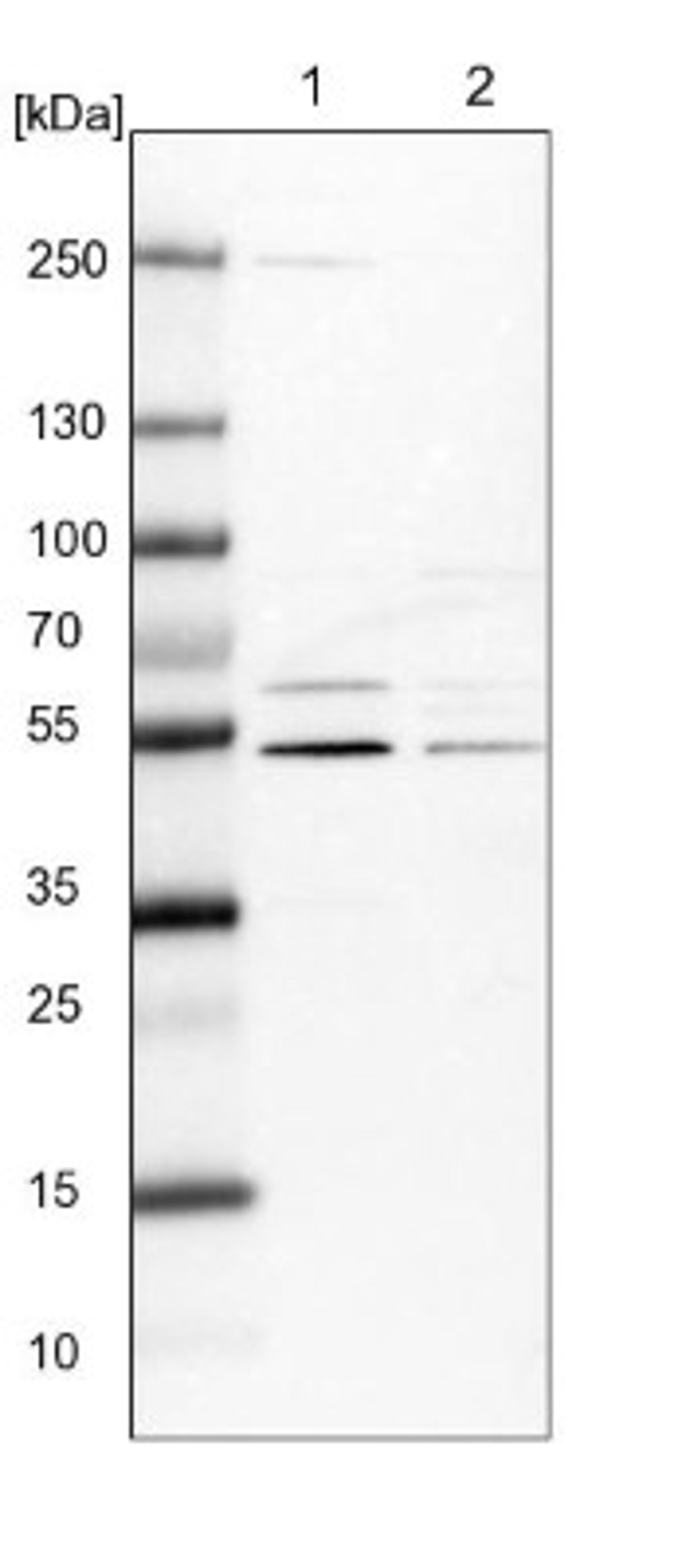 Western Blot: AMDHD1 Antibody [NBP1-82701] - Lane 1: NIH-3T3 cell lysate (Mouse embryonic fibroblast cells)<br/>Lane 2: NBT-II cell lysate (Rat Wistar bladder tumour cells)