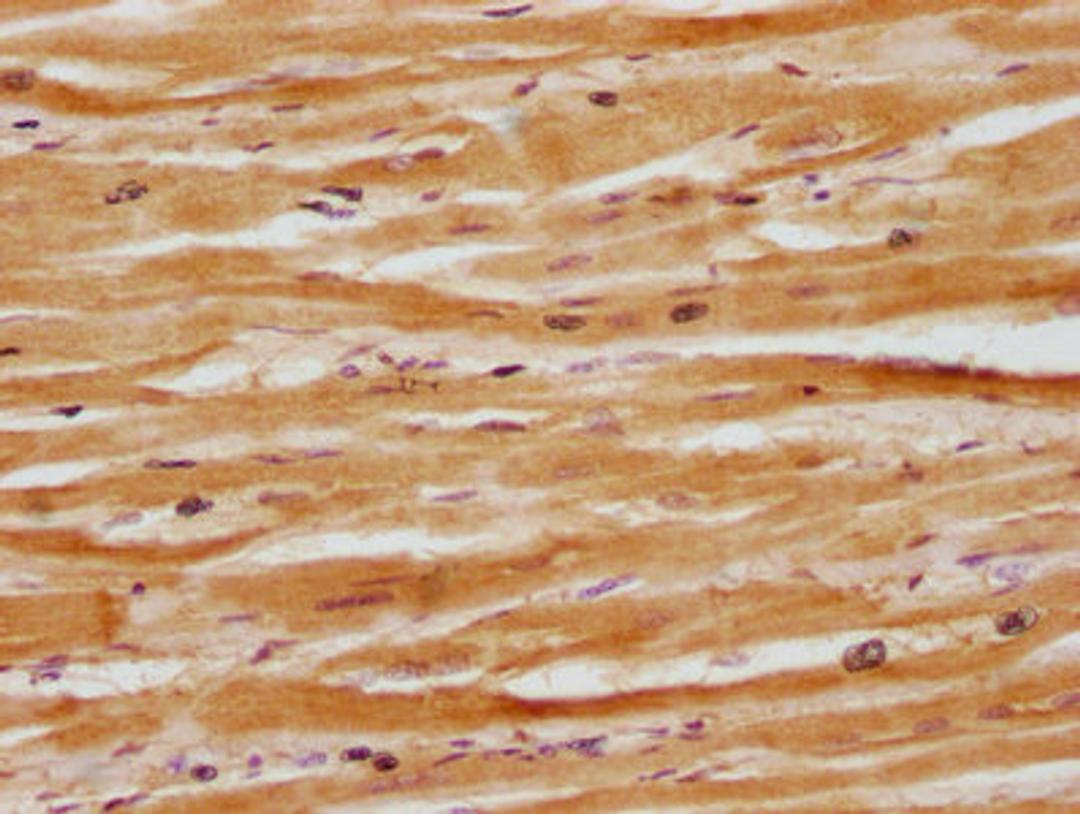 IHC image of CSB-PA839833LA01HU diluted at 1:100 and staining in paraffin-embedded human heart tissue performed on a Leica BondTM system. After dewaxing and hydration, antigen retrieval was mediated by high pressure in a citrate buffer (pH 6.0). Section was blocked with 10% normal goat serum 30min at RT. Then primary antibody (1% BSA) was incubated at 4°C overnight. The primary is detected by a biotinylated secondary antibody and visualized using an HRP conjugated SP system.